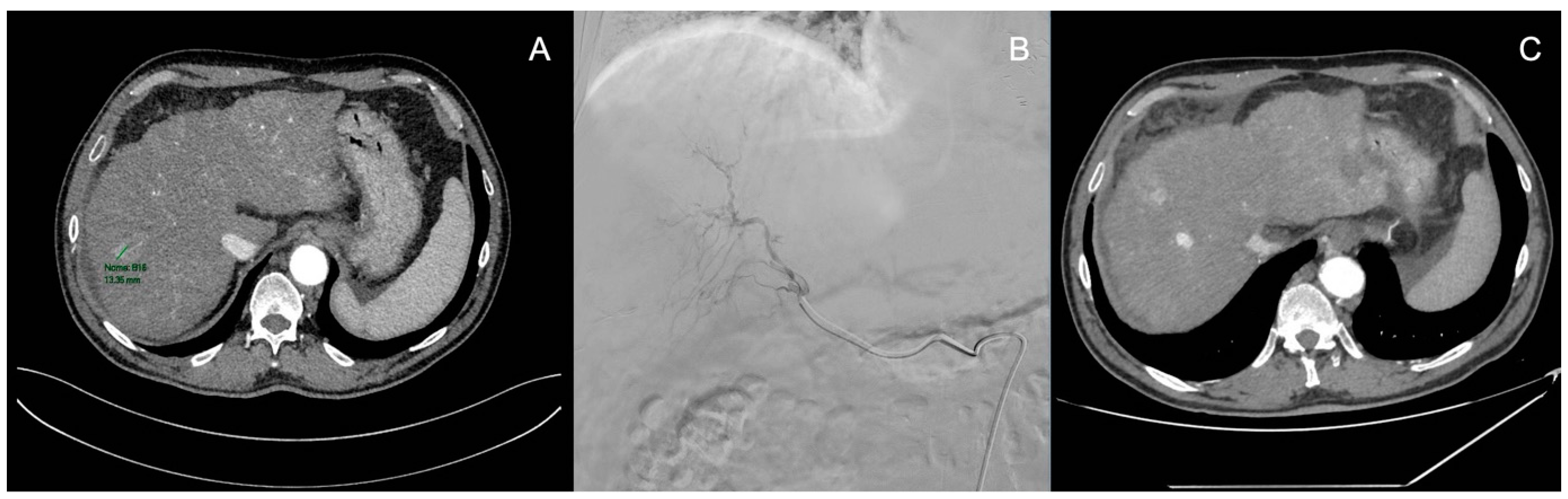 Medicina 60 01010 g003
