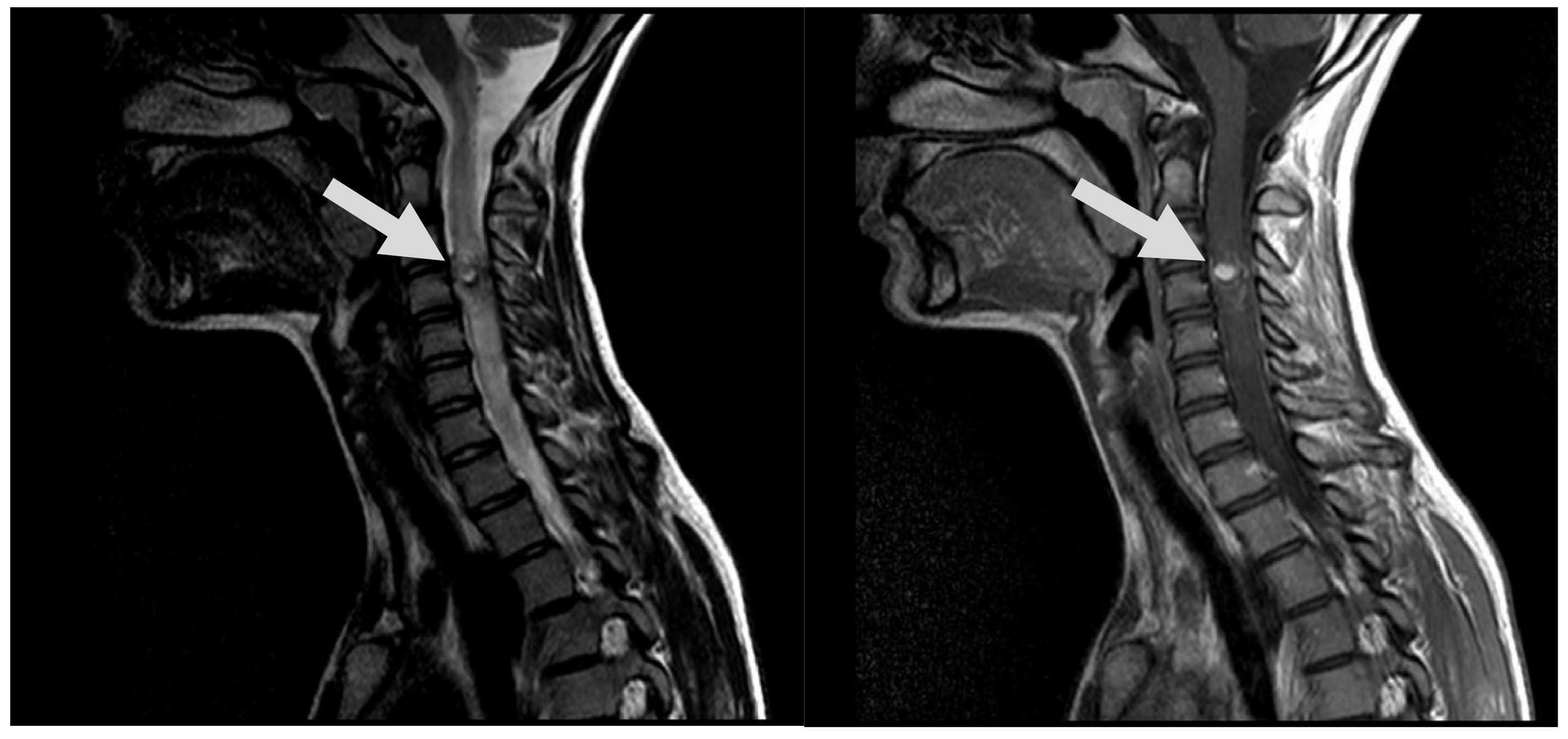Medicina 60 01011 g001
