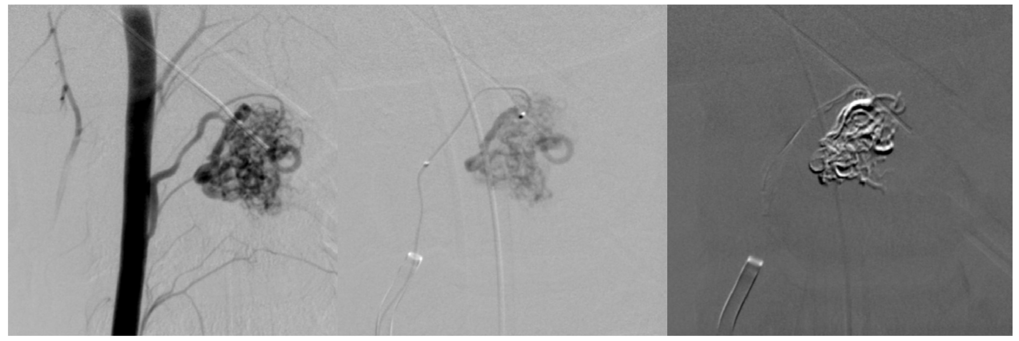 Medicina 60 01011 g003