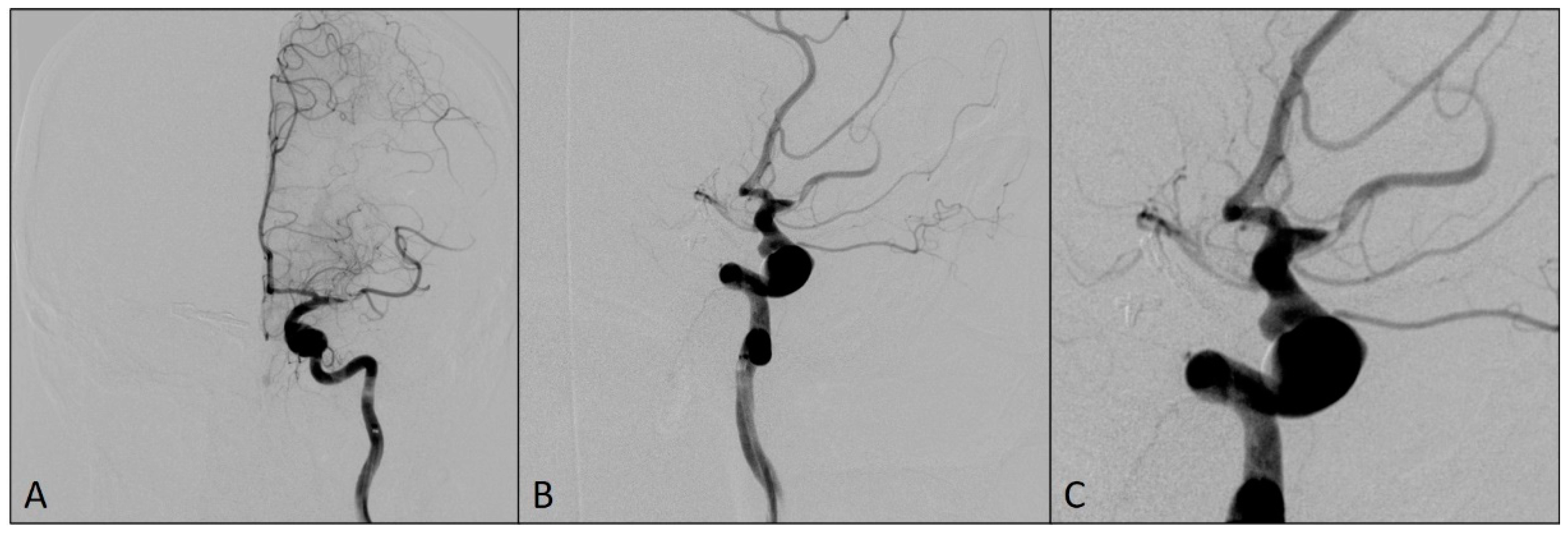 Medicina 60 01034 g002