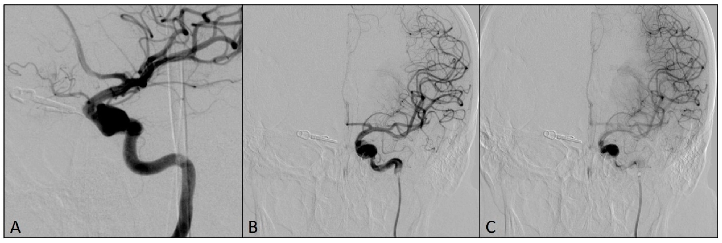 Medicina 60 01034 g004