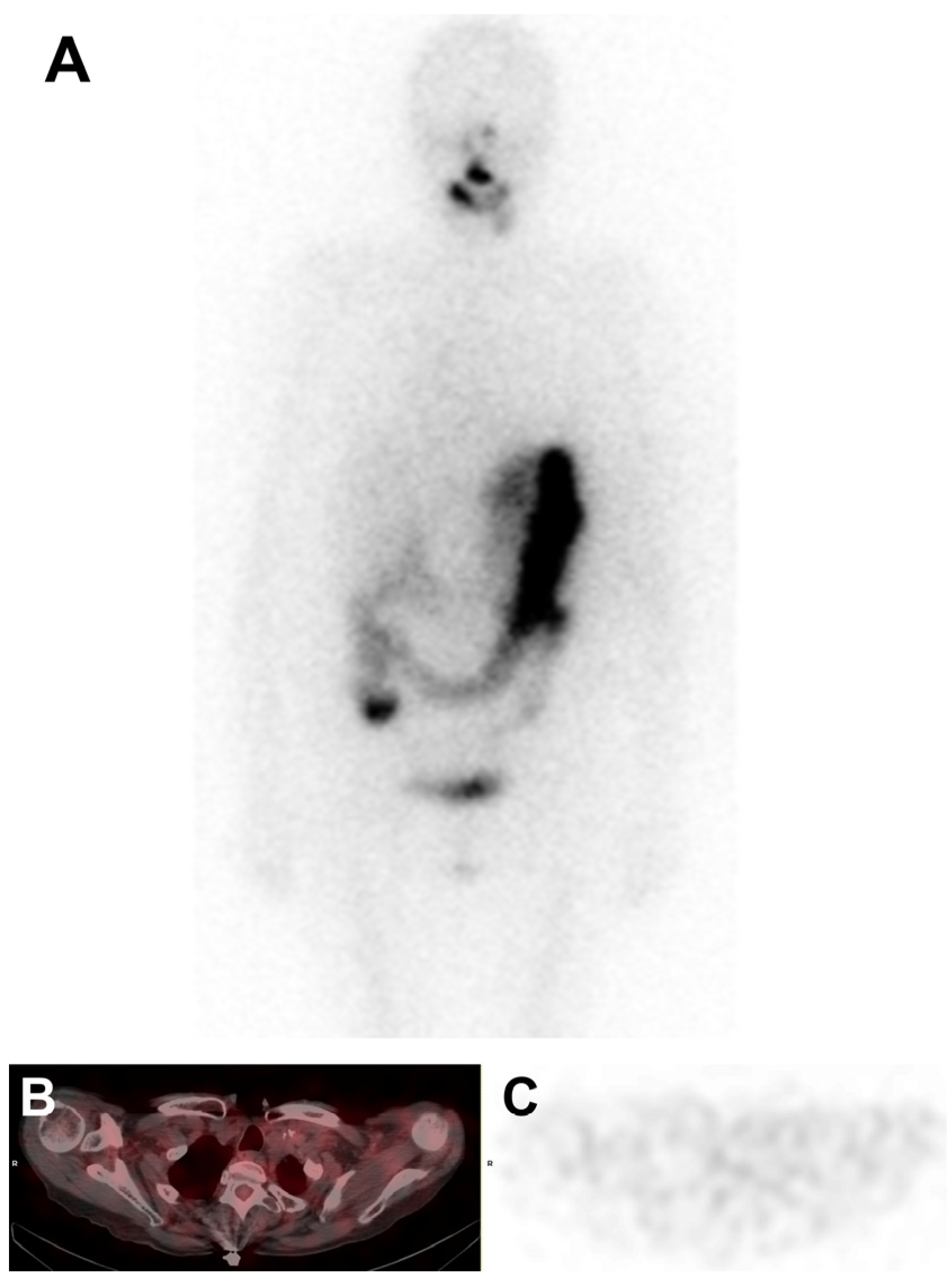 Medicina 60 01037 g004