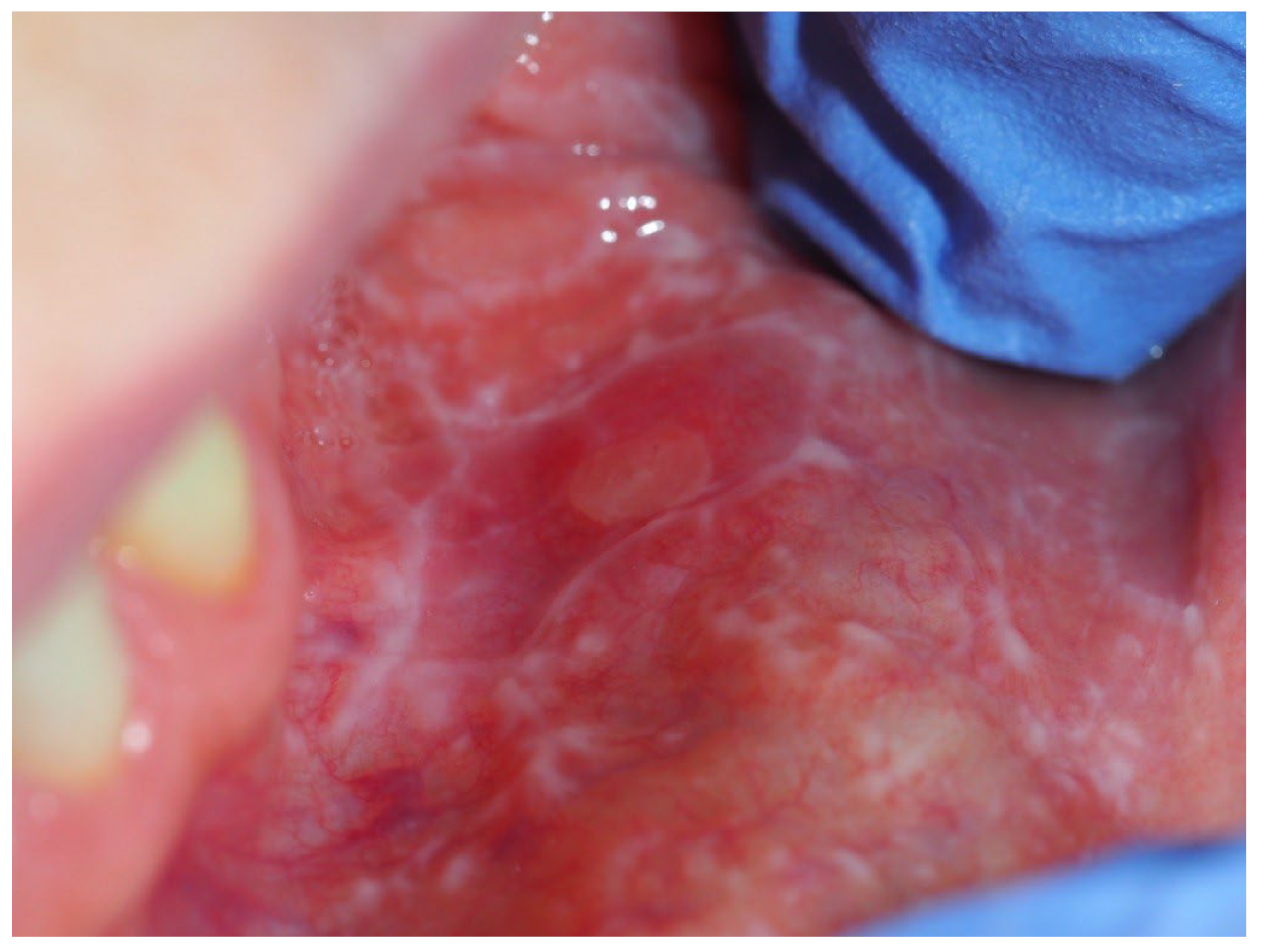 Medicina 60 01038 g001