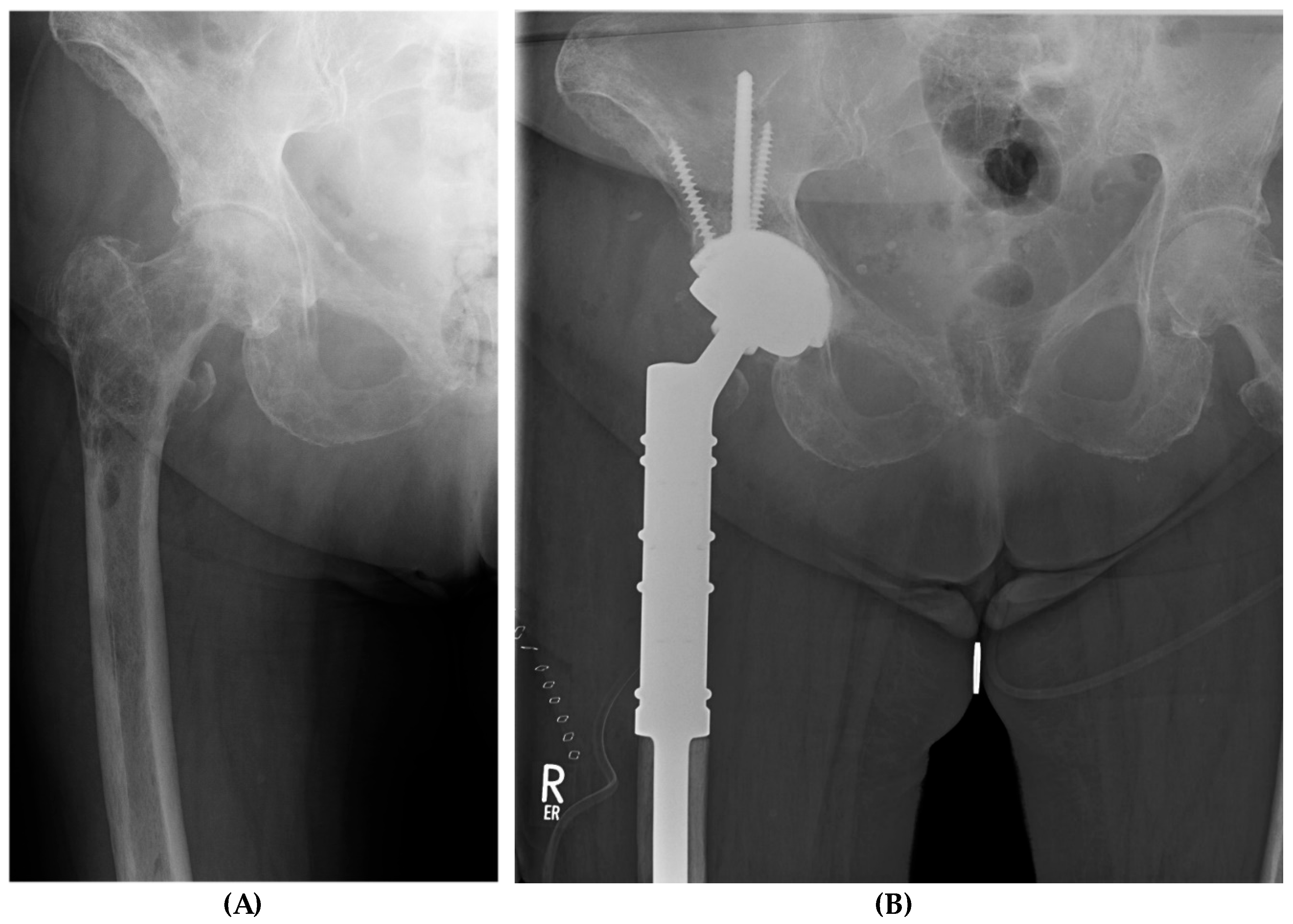 Medicina 60 01047 g001