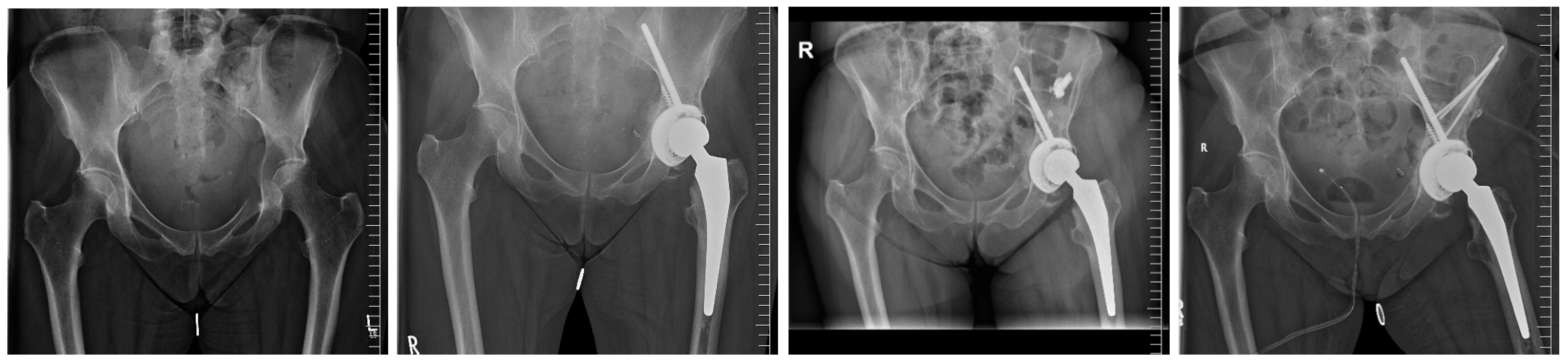 Medicina 60 01047 g002