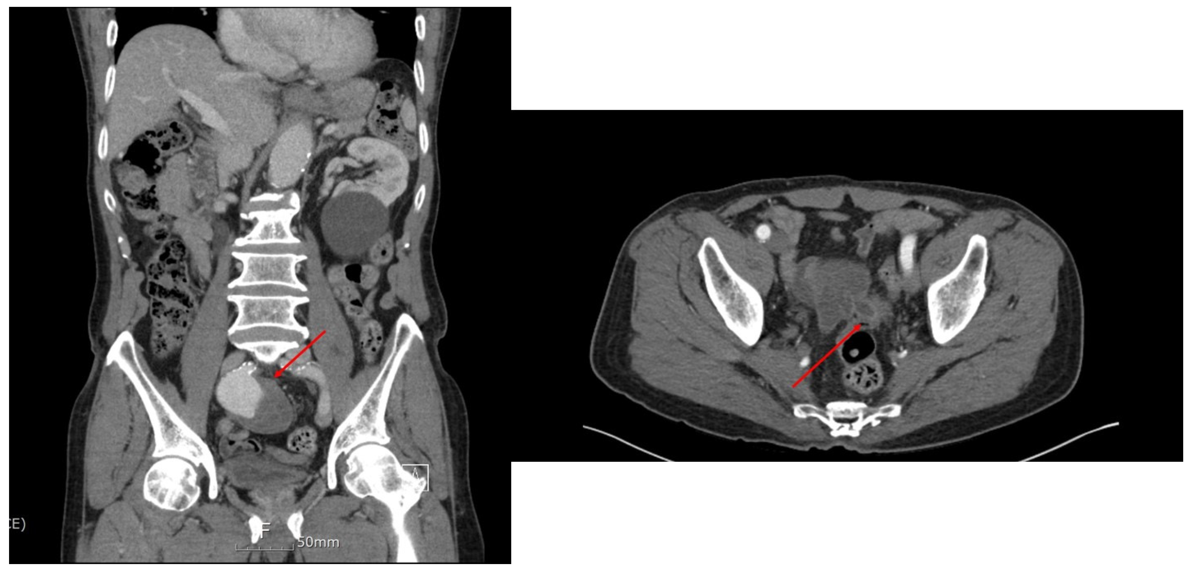 Medicina 60 01052 g001