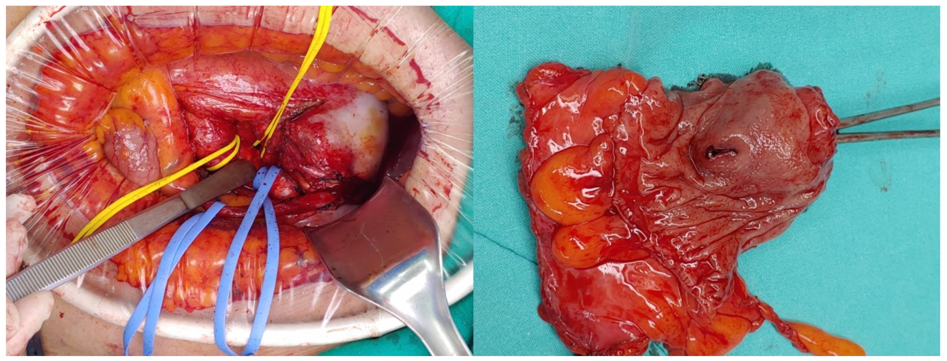 Medicina 60 01052 g002