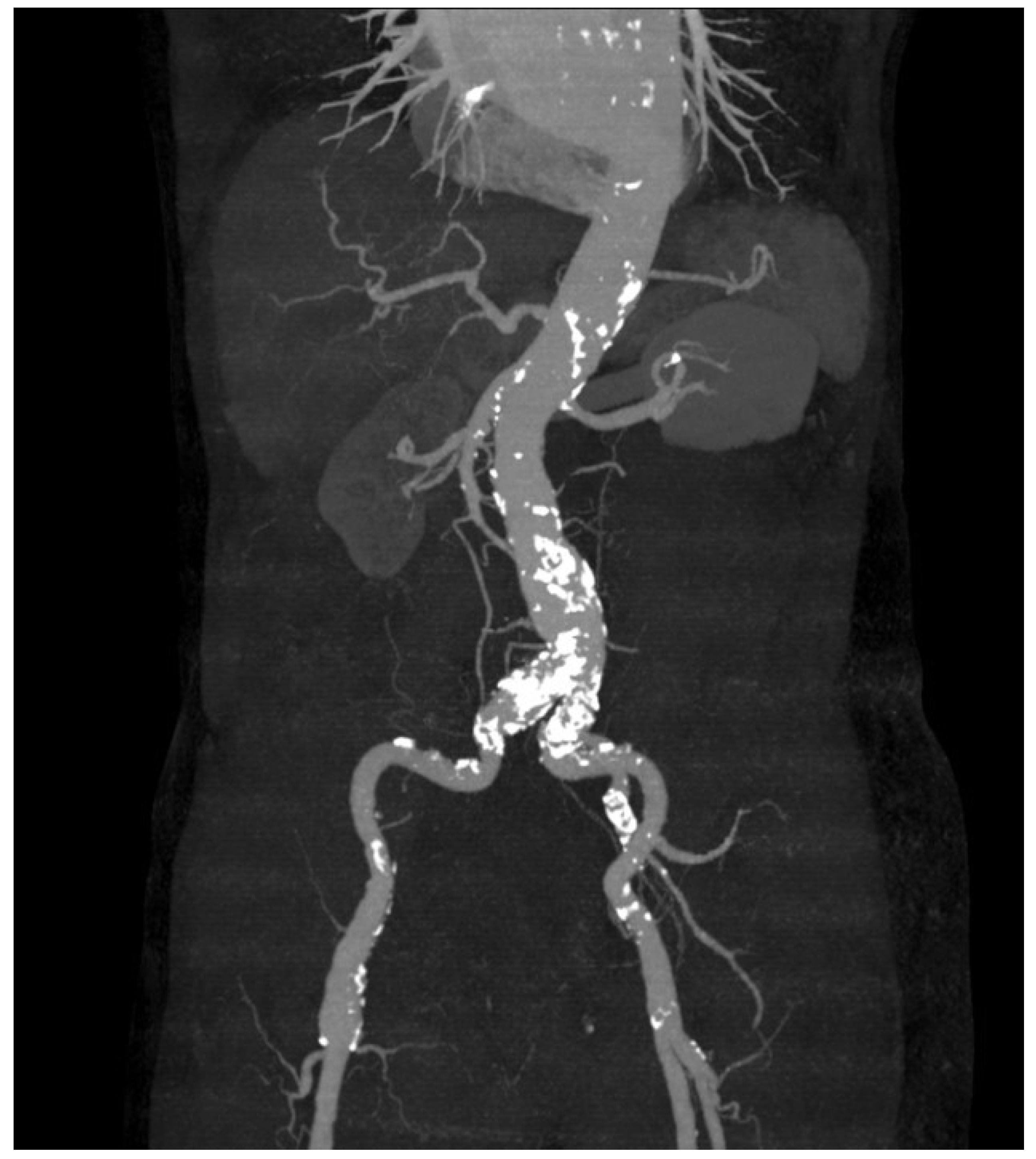 Medicina 60 01052 g003