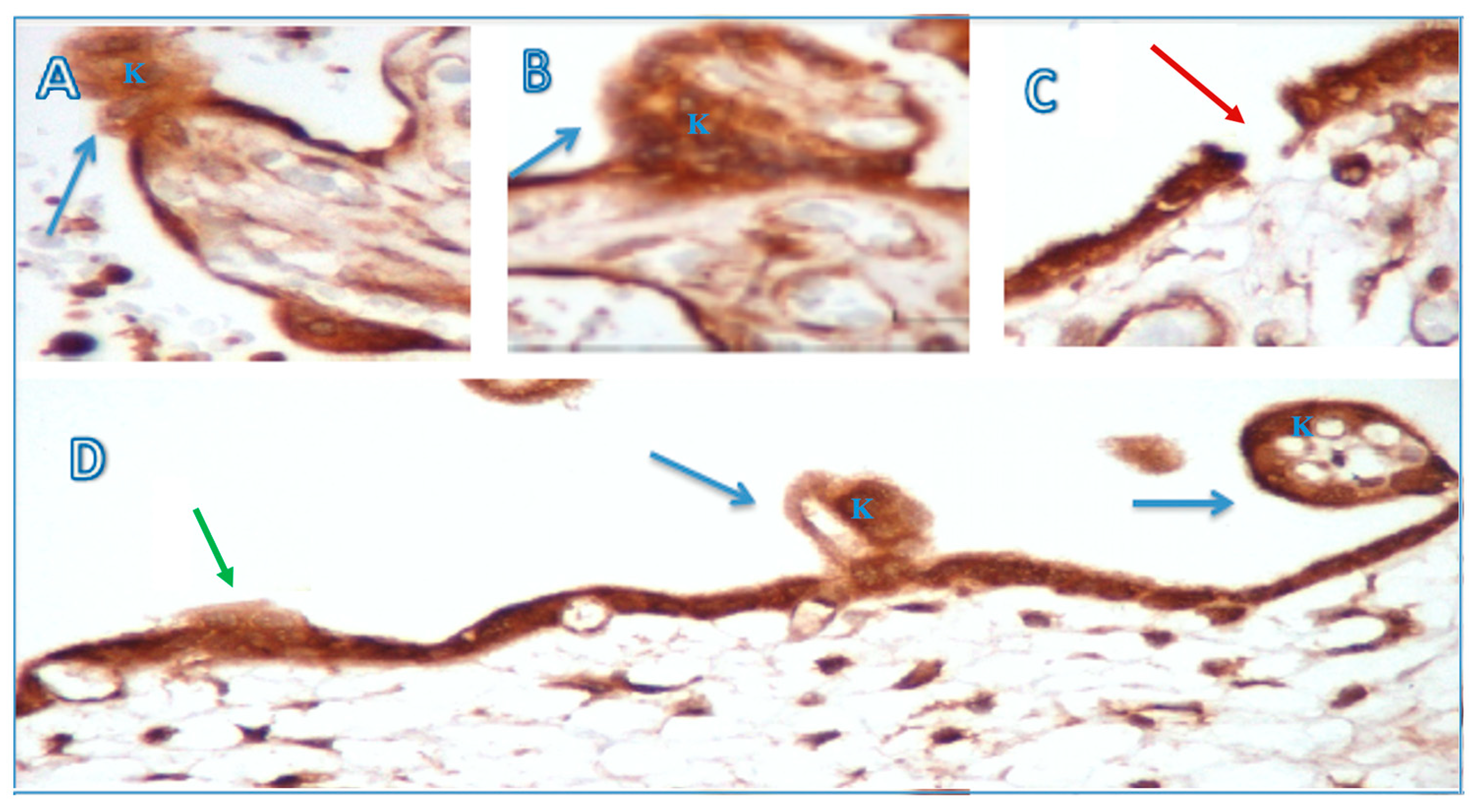 Medicina 60 01077 g002