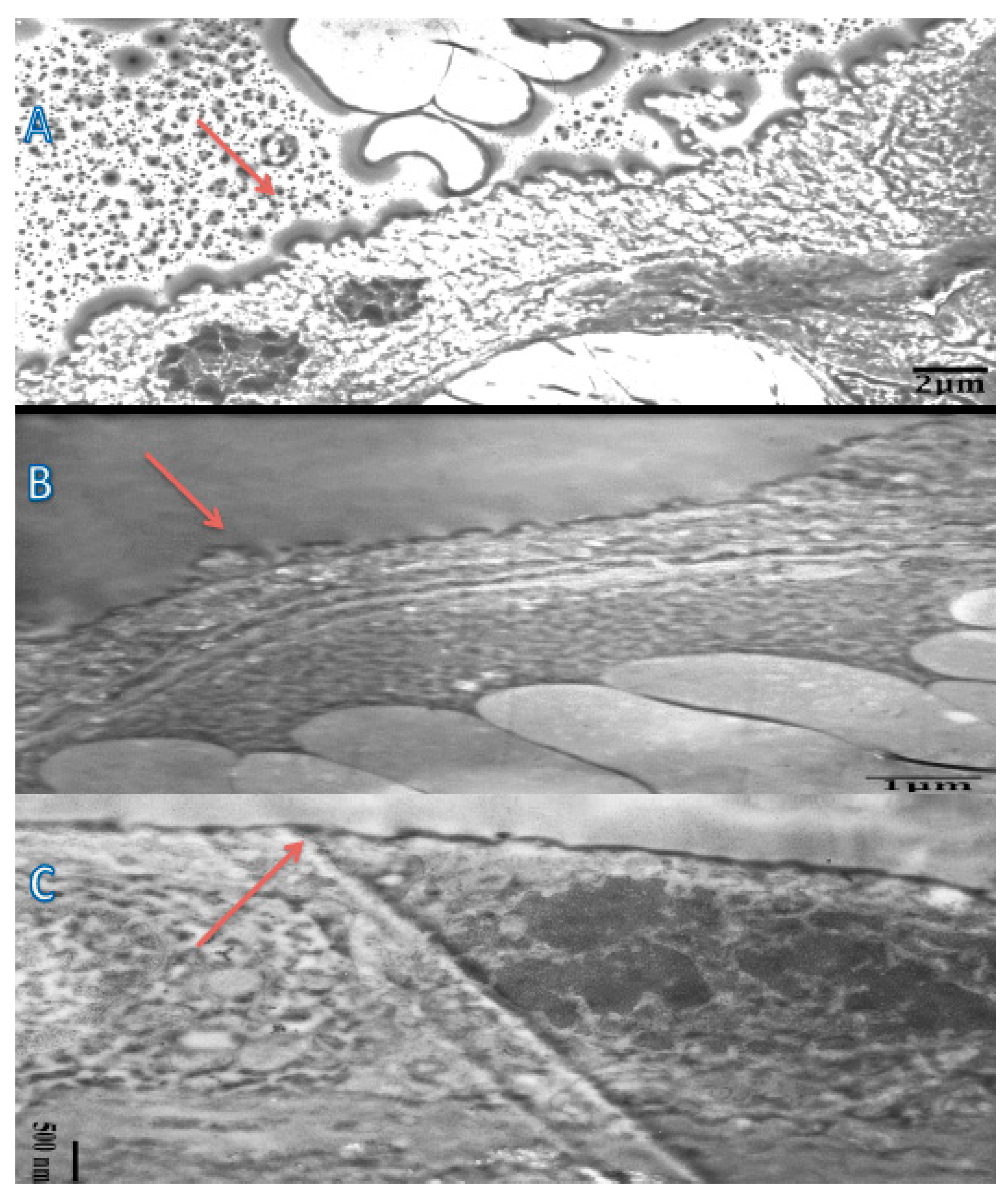 Medicina 60 01077 g003