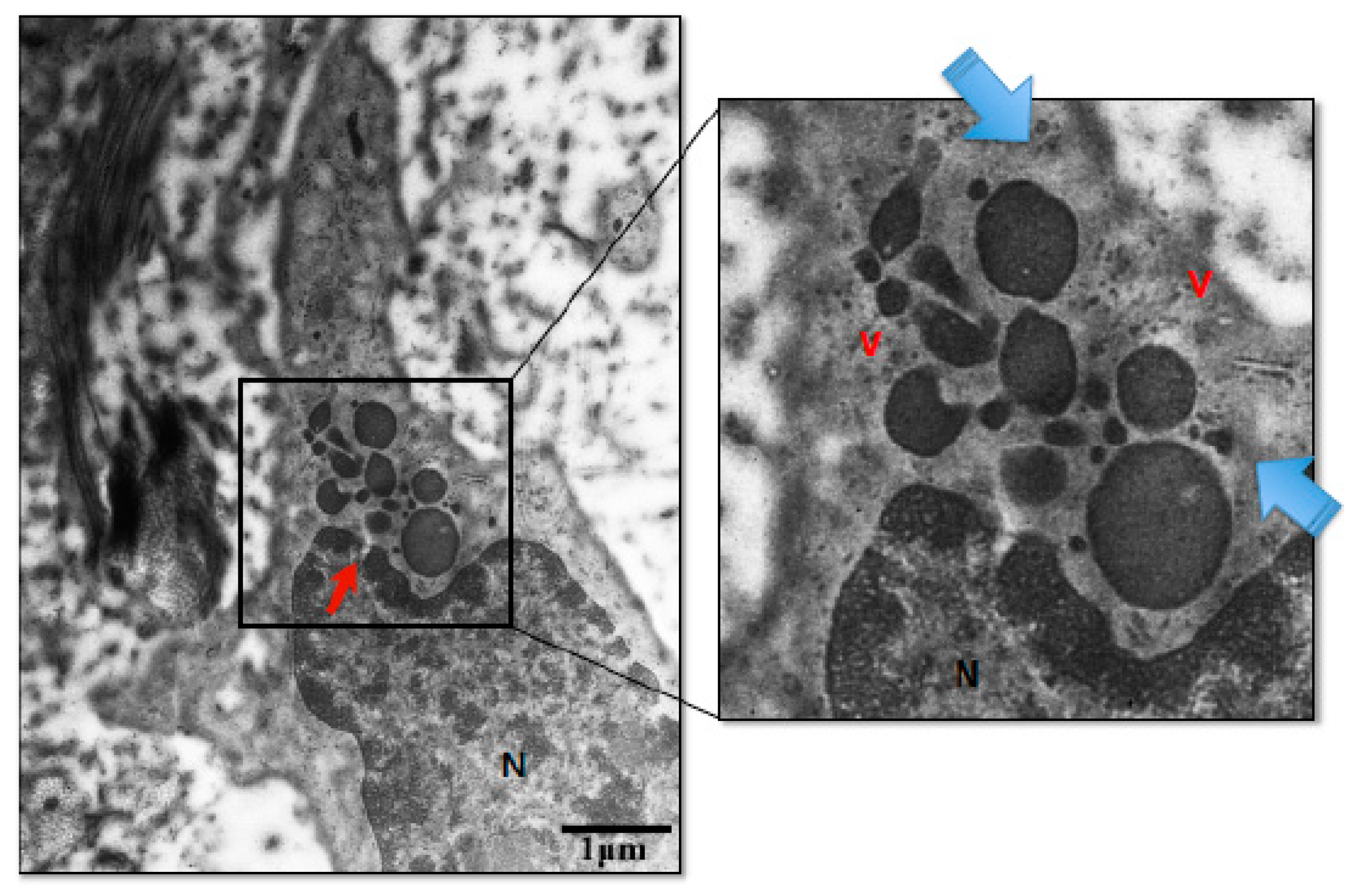 Medicina 60 01077 g005