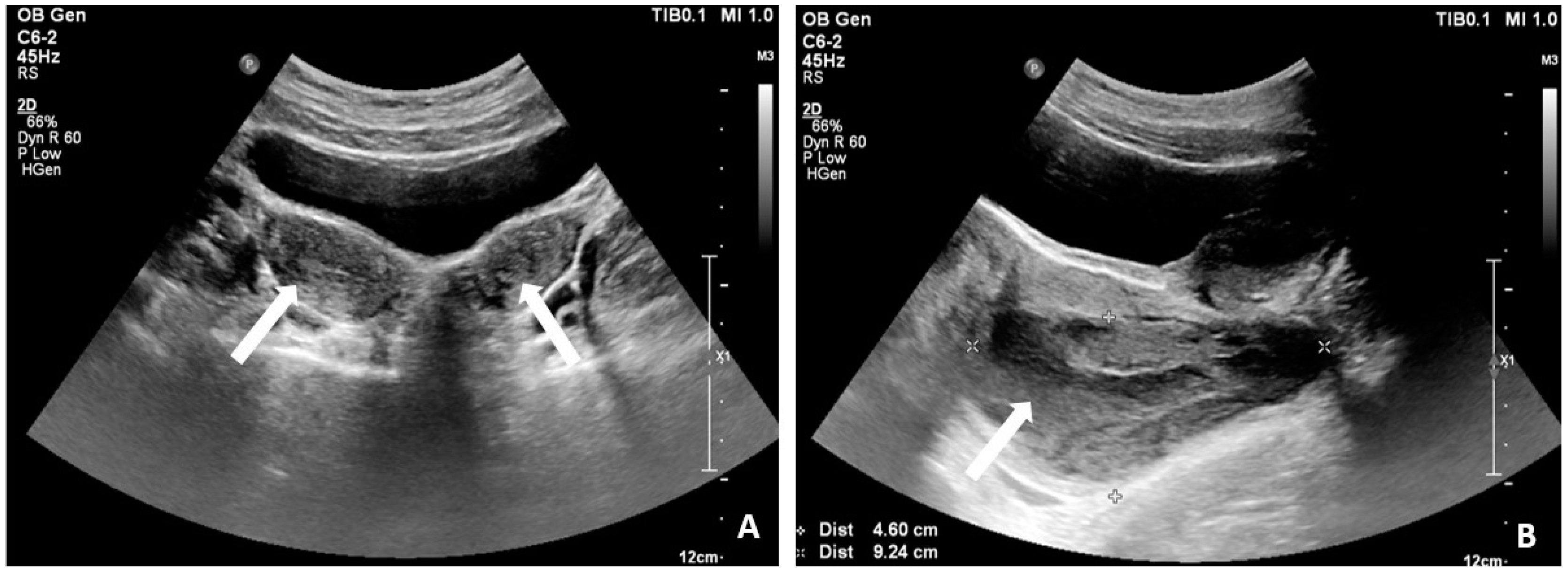 Medicina 60 01081 g001