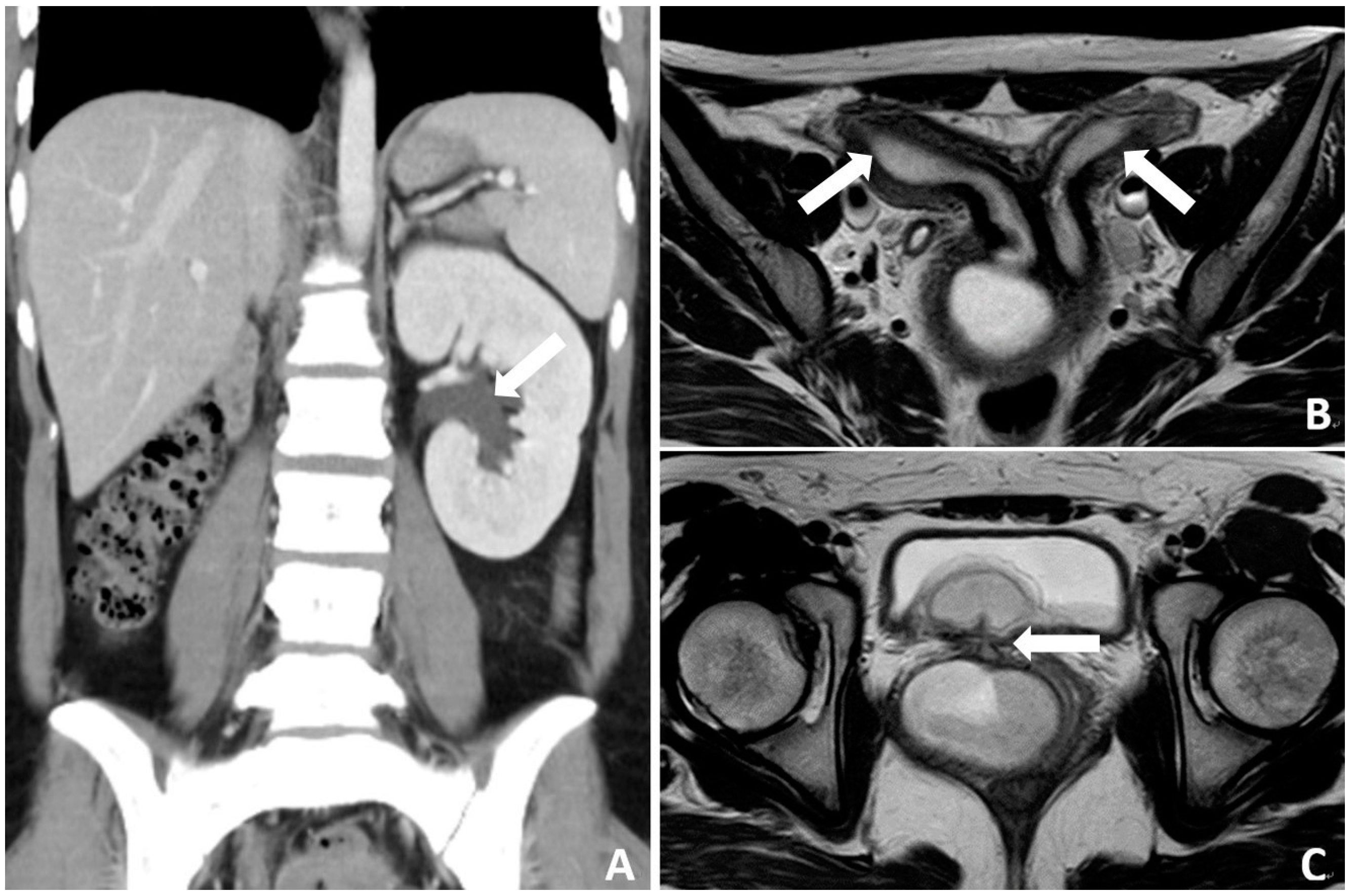 Medicina 60 01081 g002
