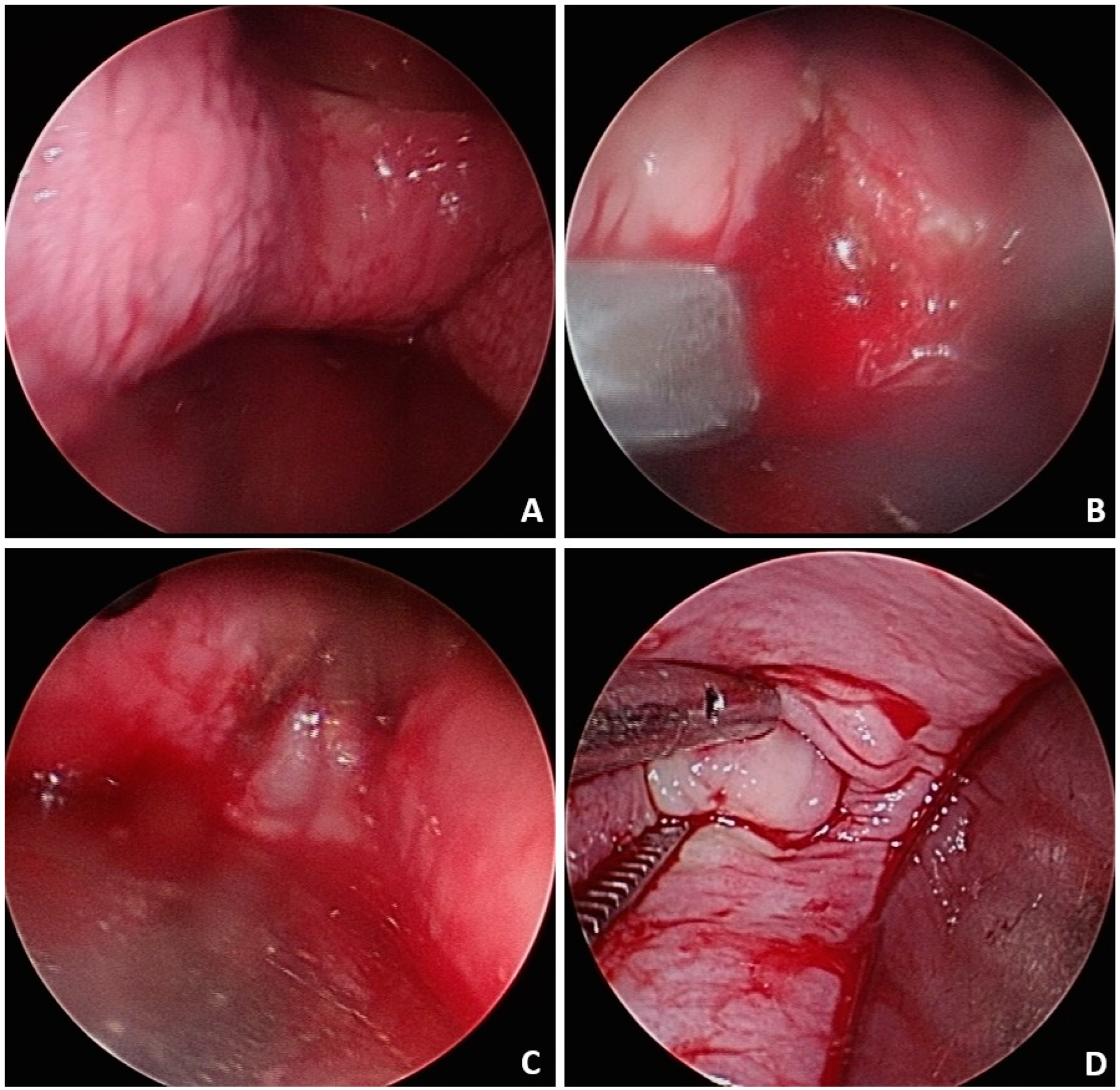 Medicina 60 01081 g003