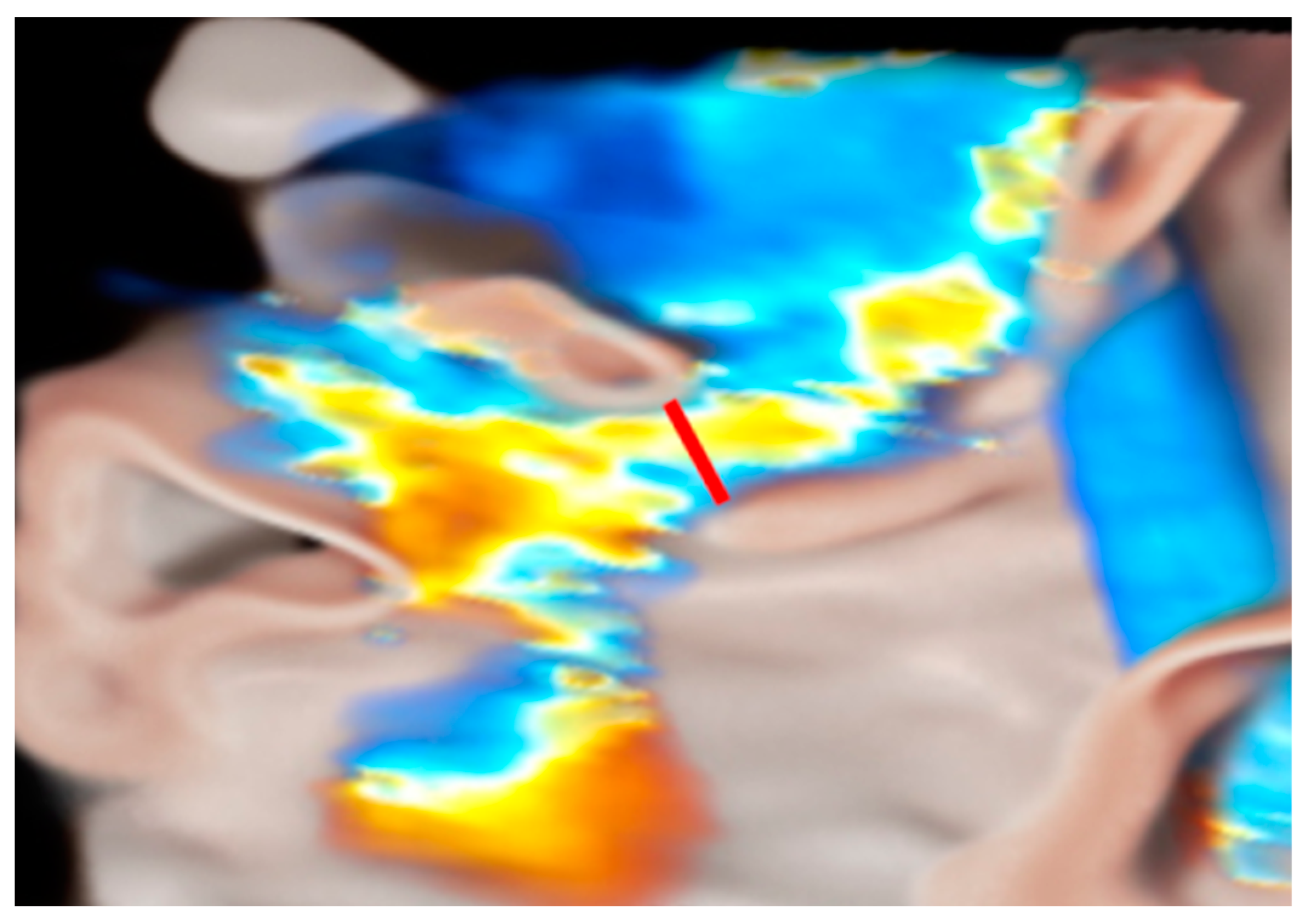 Medicina 60 01082 g005