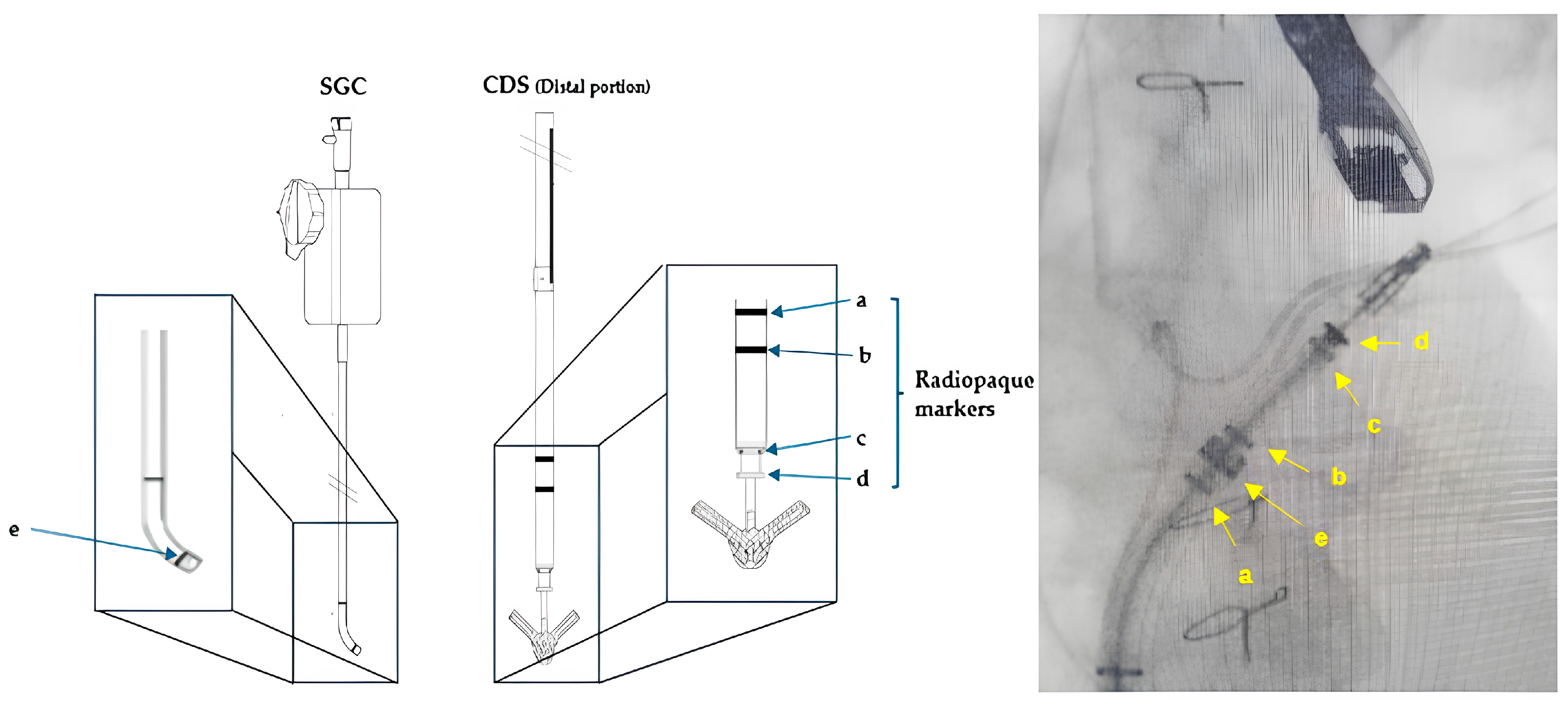 Medicina 60 01082 g008