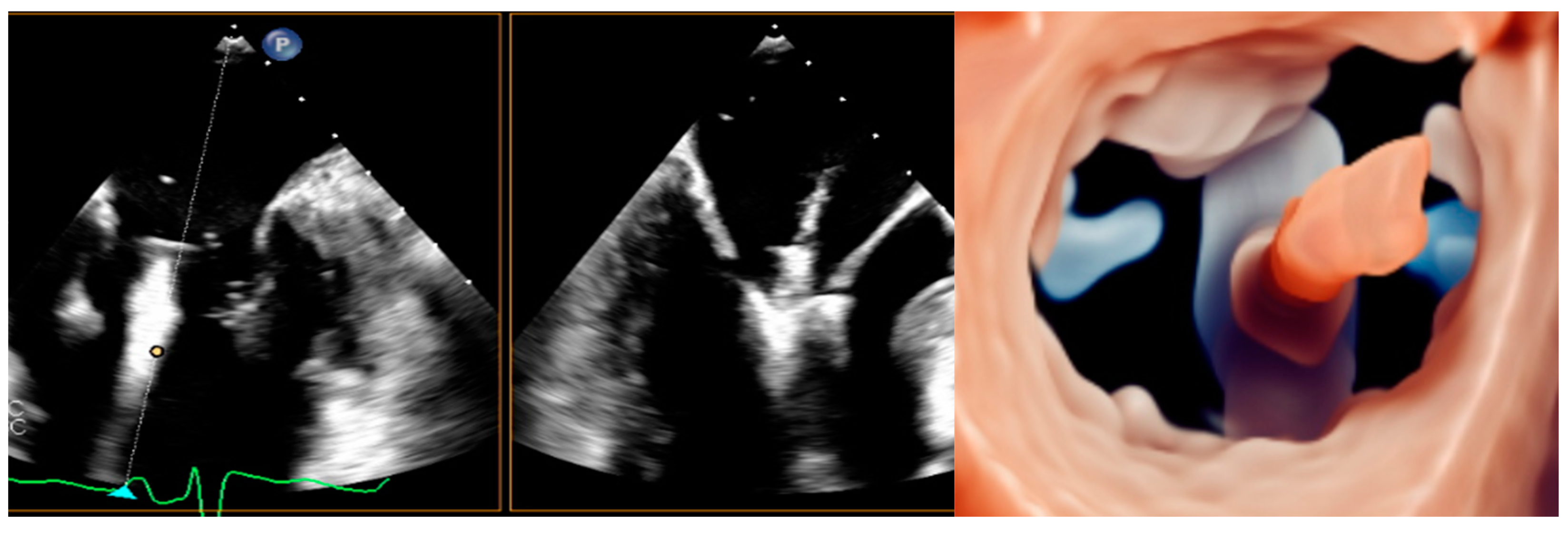 Medicina 60 01082 g009