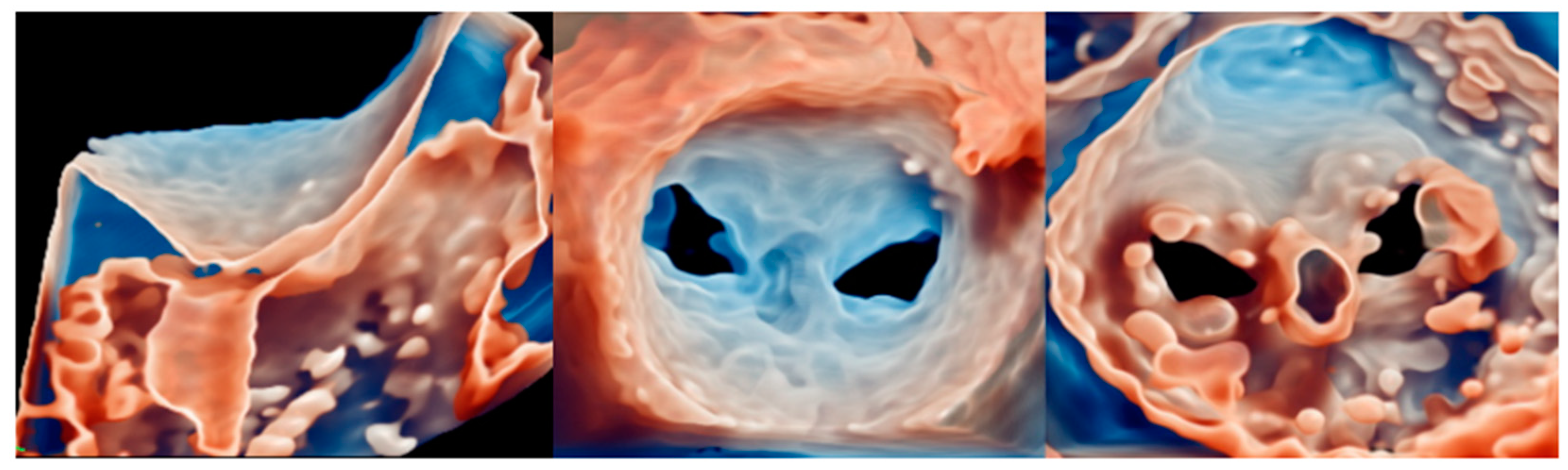 Medicina 60 01082 g010