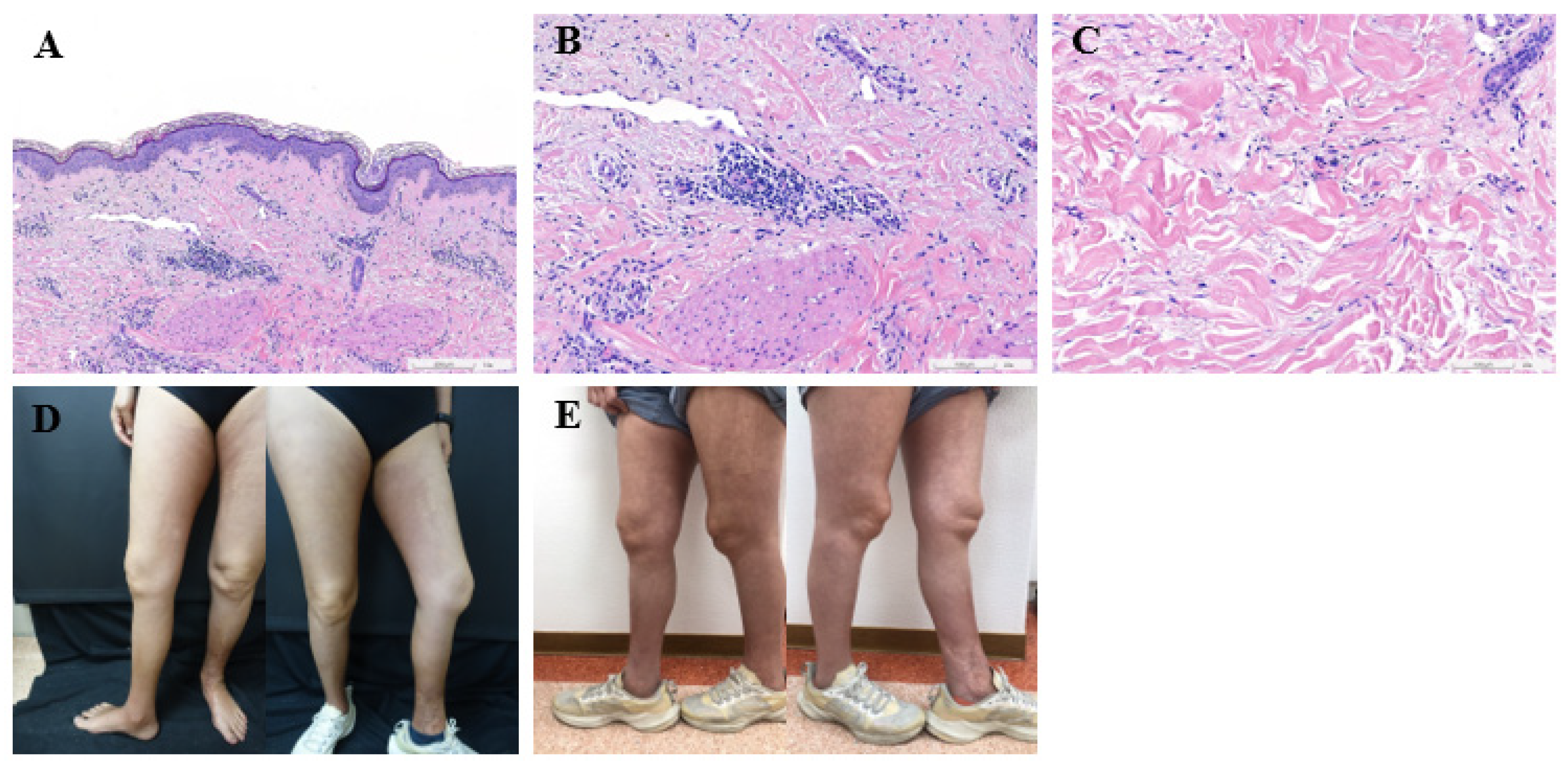 Medicina 60 01092 g001