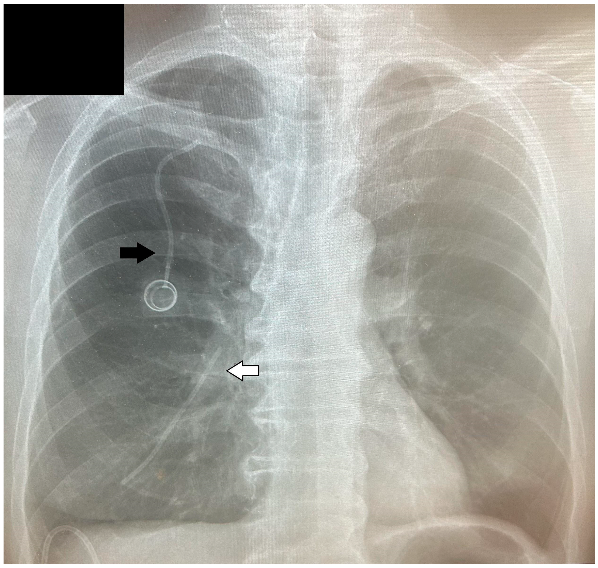 Medicina 60 01093 g001