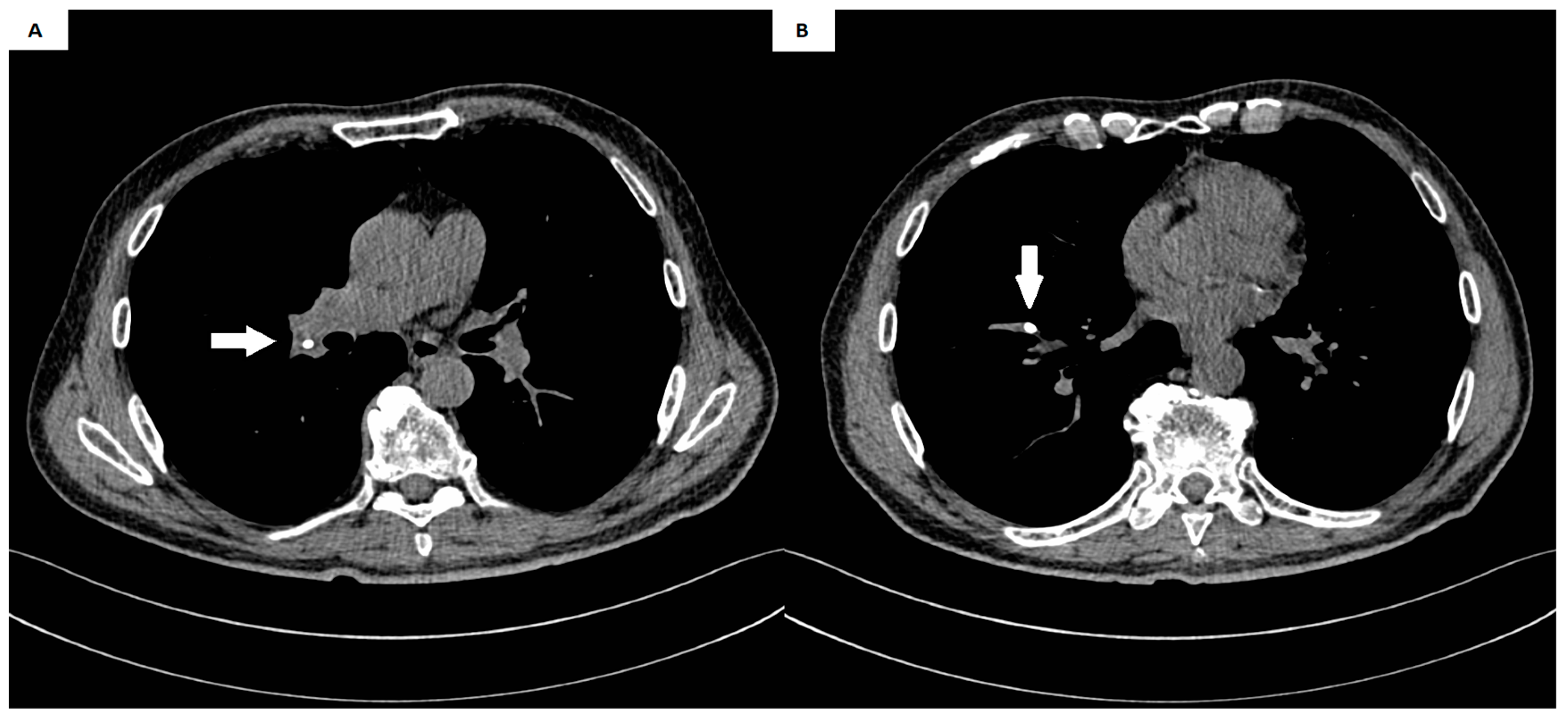 Medicina 60 01093 g002