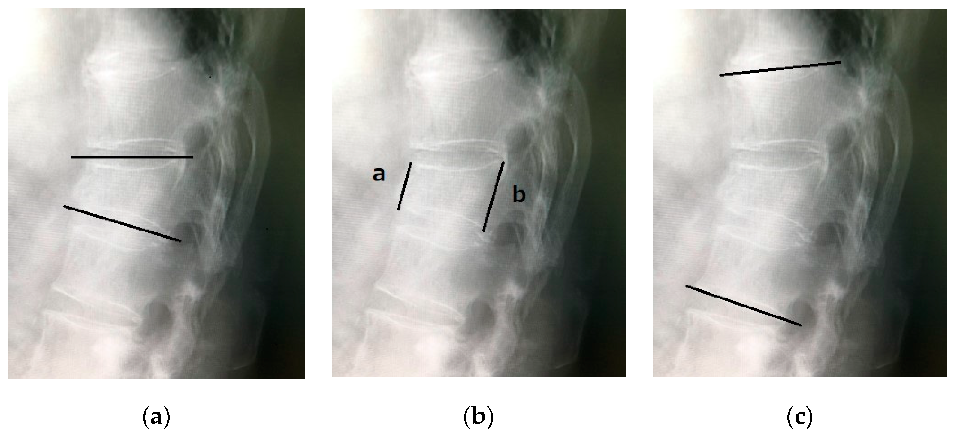 Medicina 60 01097 g001