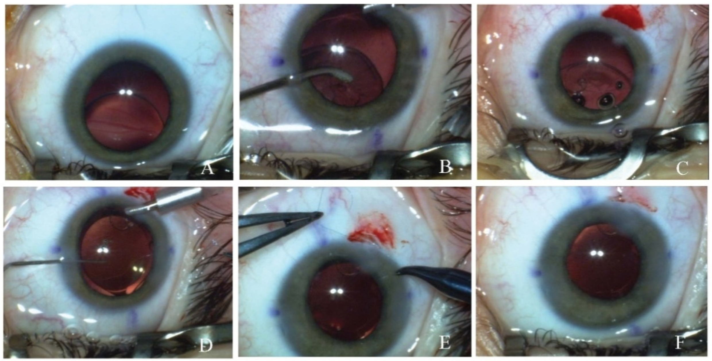 Medicina 60 01098 g002