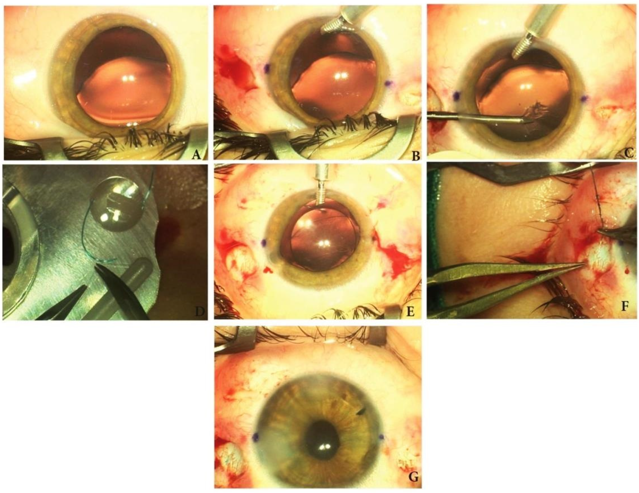 Medicina 60 01098 g003