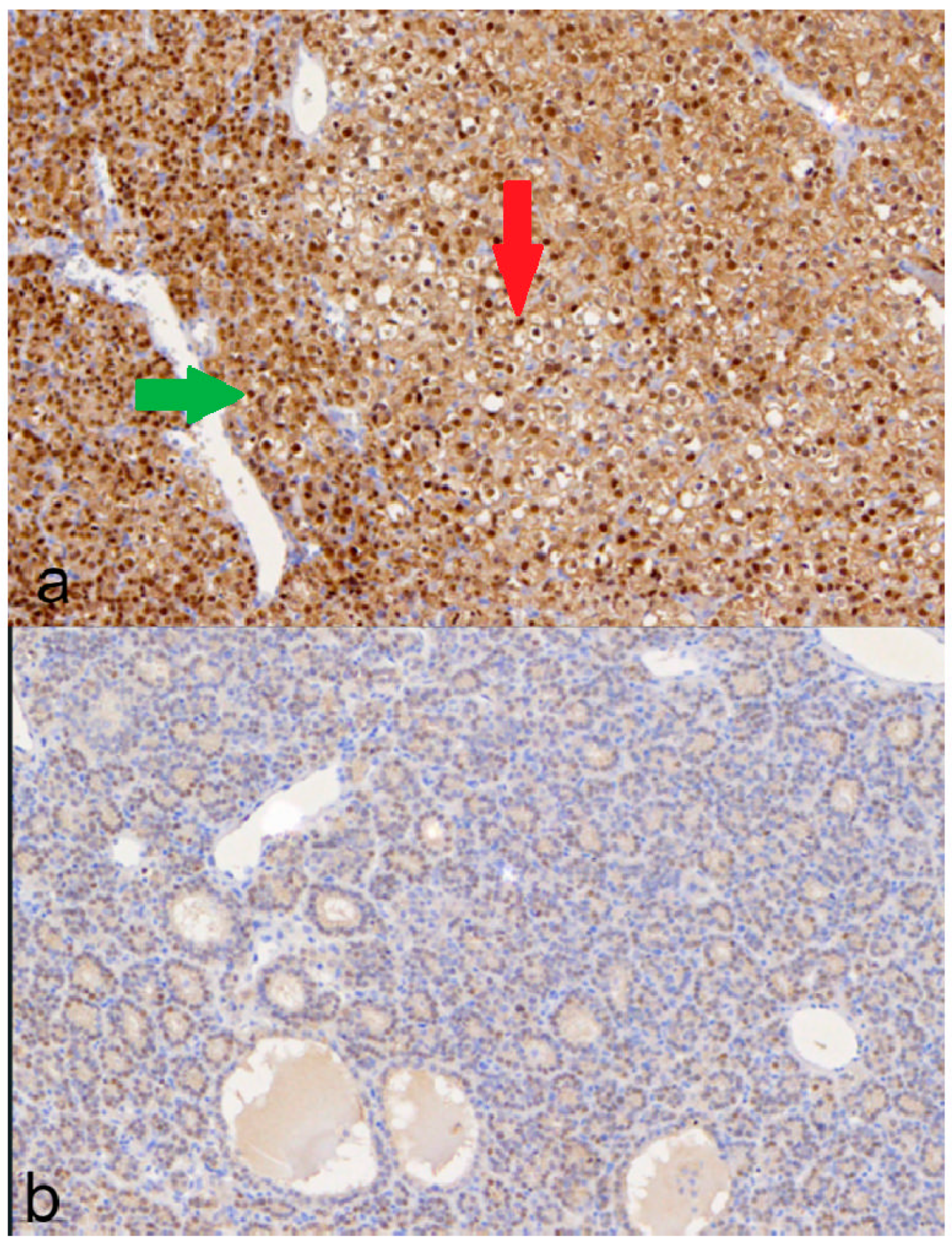 Medicina 60 01100 g004
