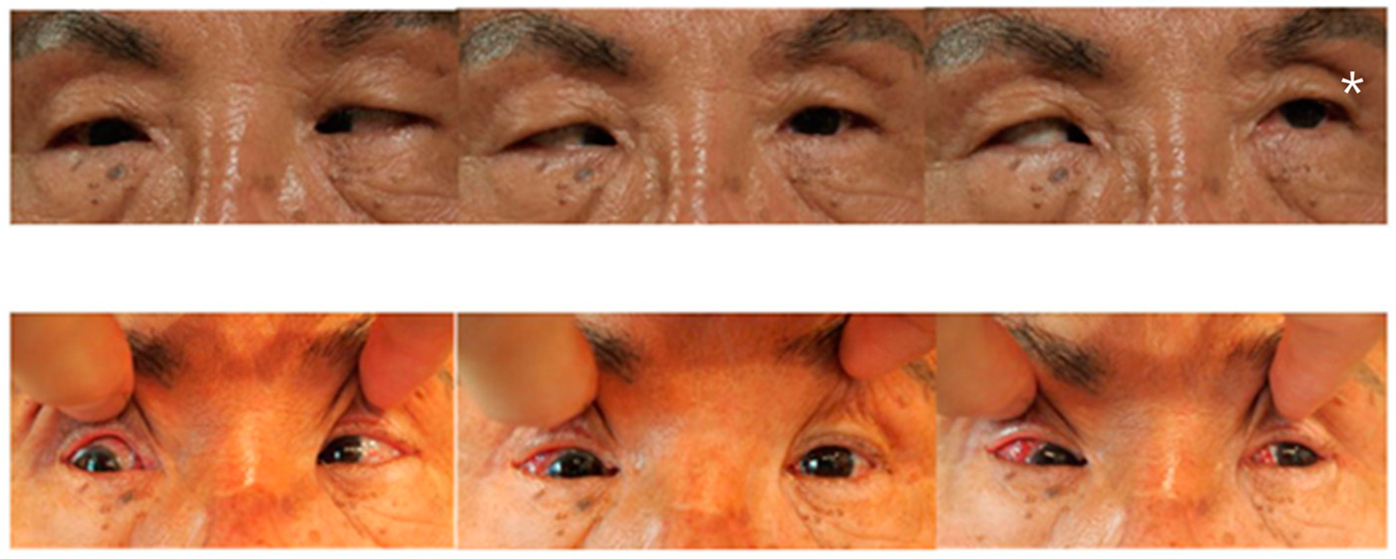 Medicina 60 01104 g001