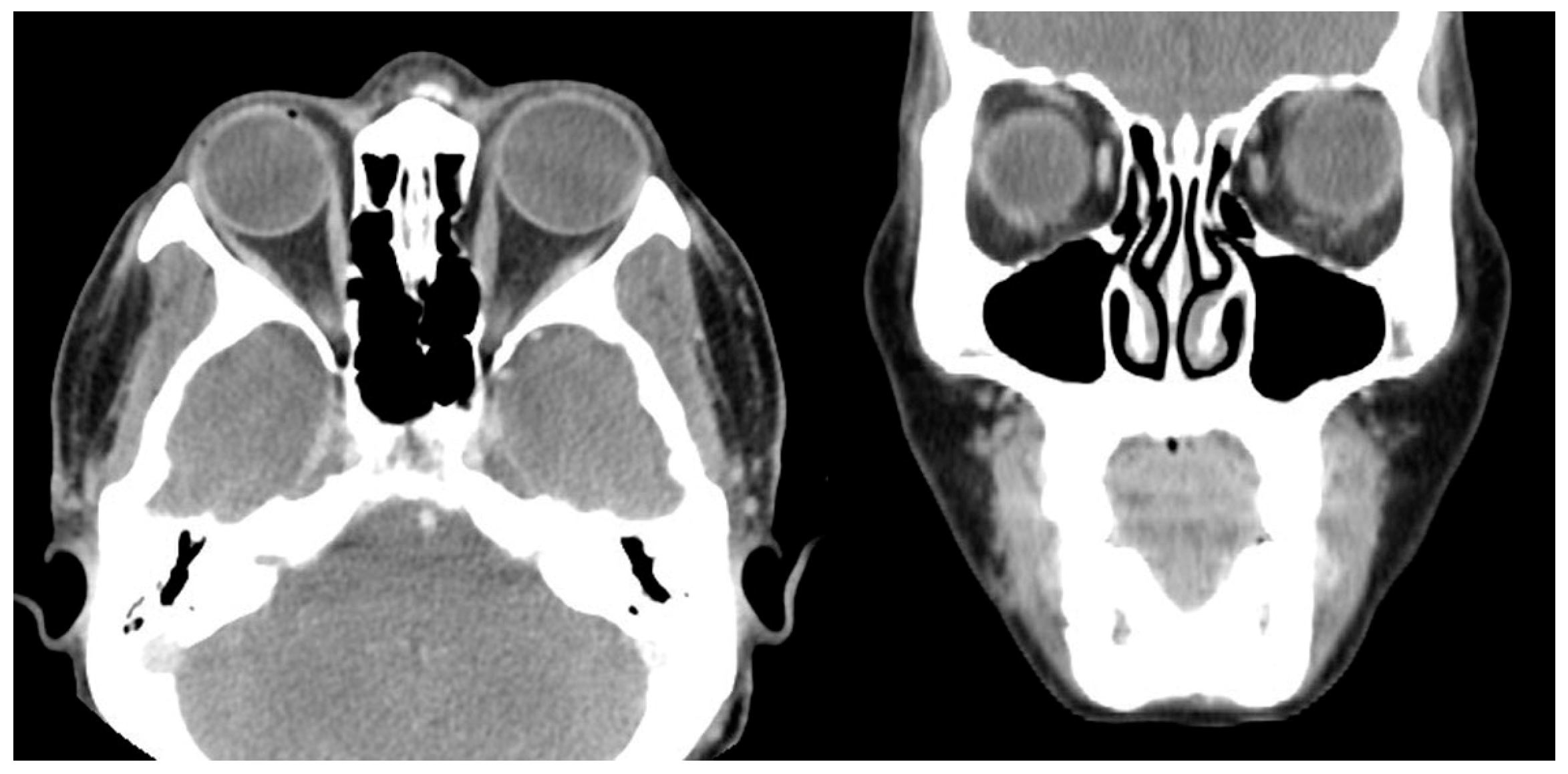 Medicina 60 01104 g004