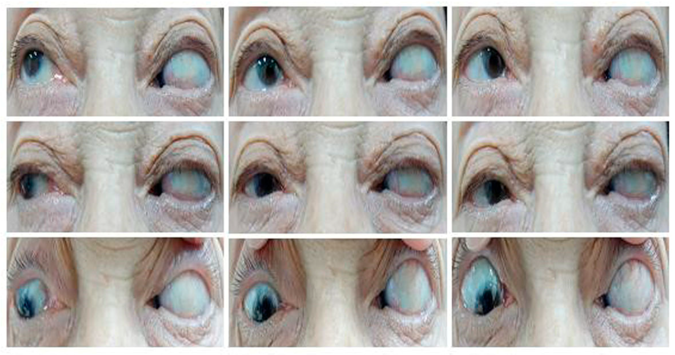 Medicina 60 01104 g005