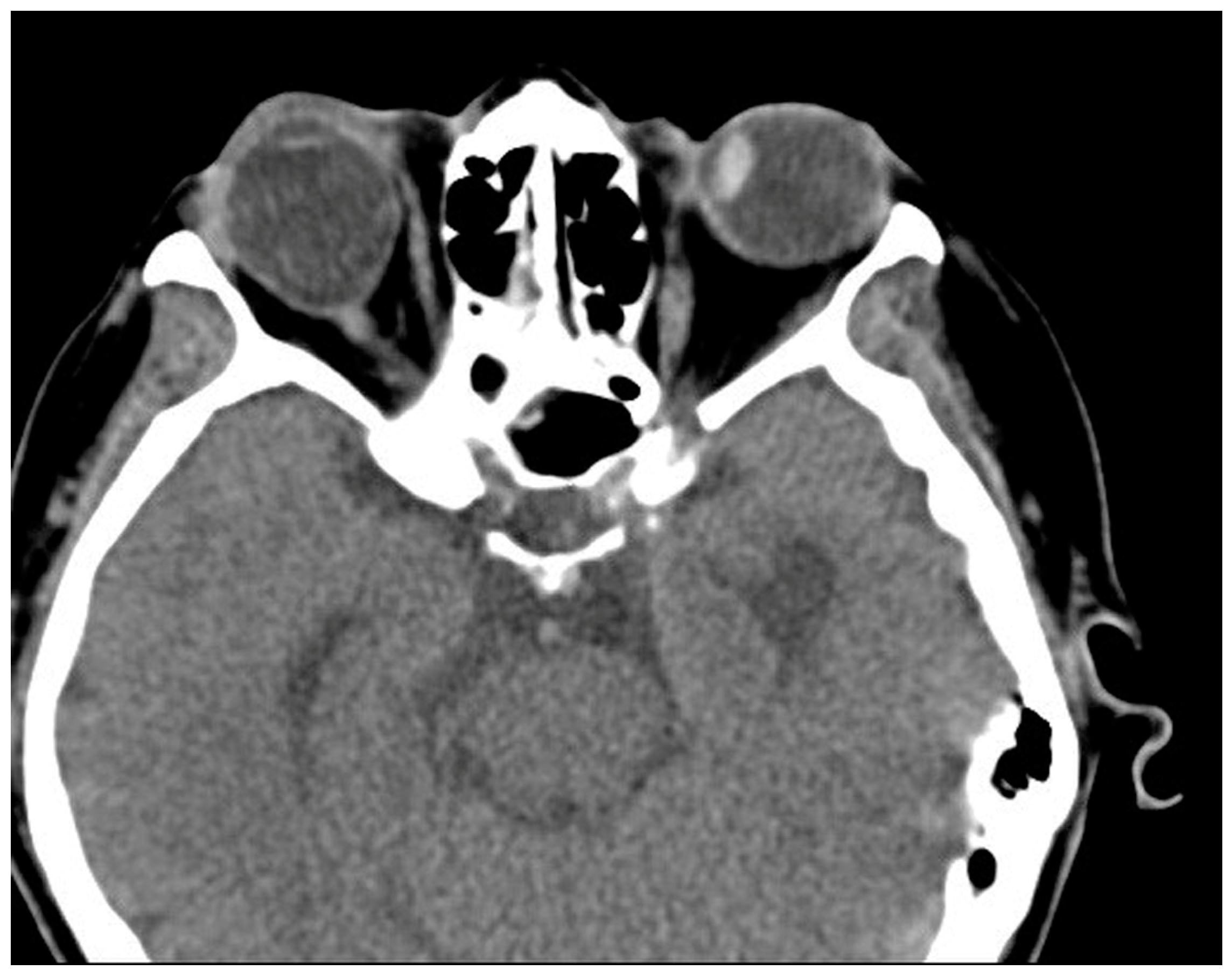 Medicina 60 01104 g006