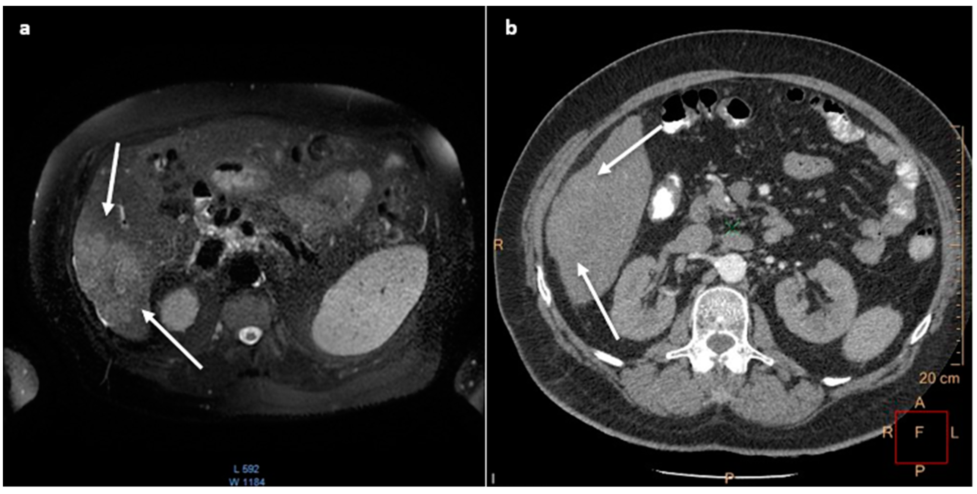 Medicina 60 01109 g002