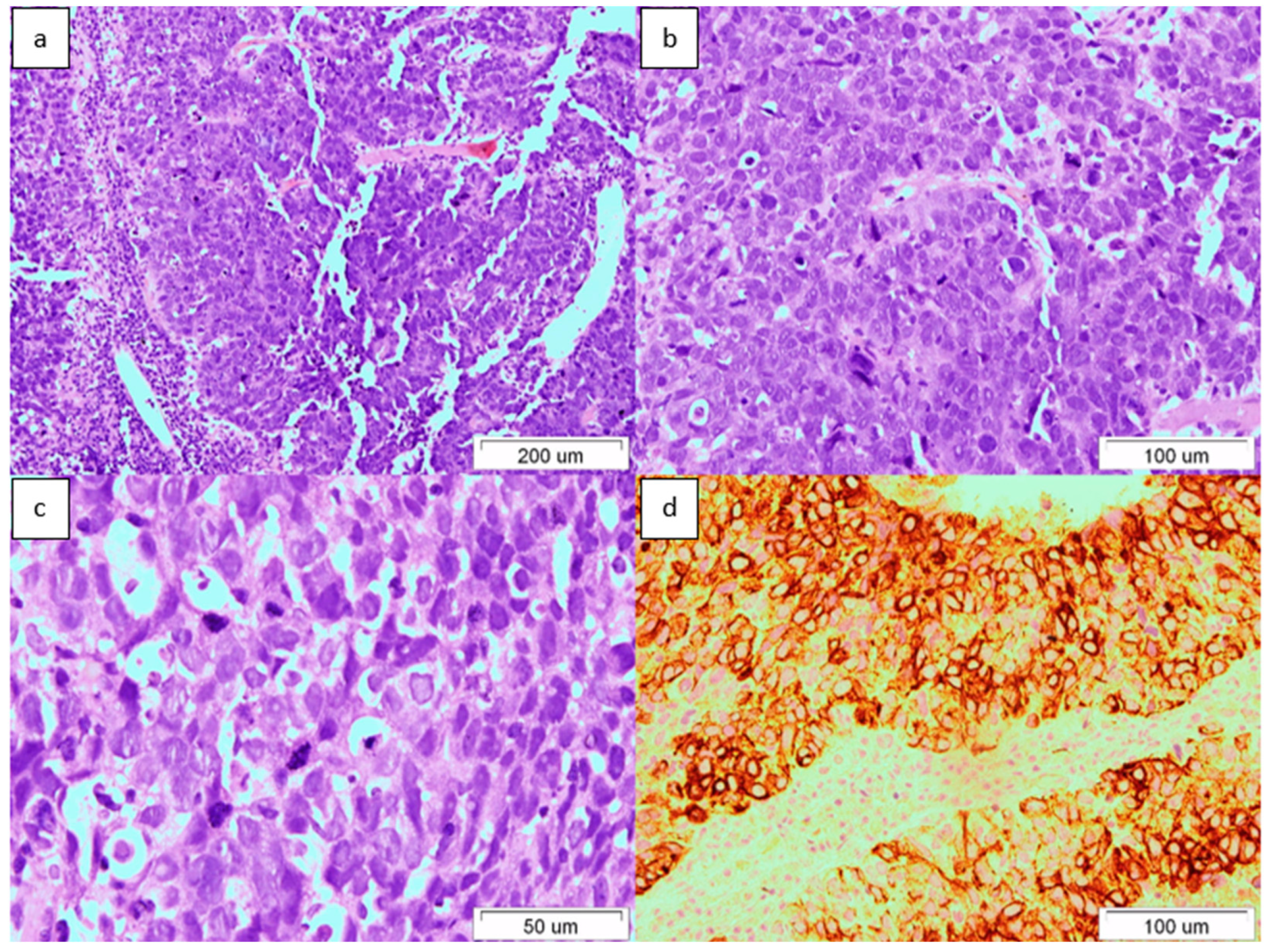 Medicina 60 01109 g003