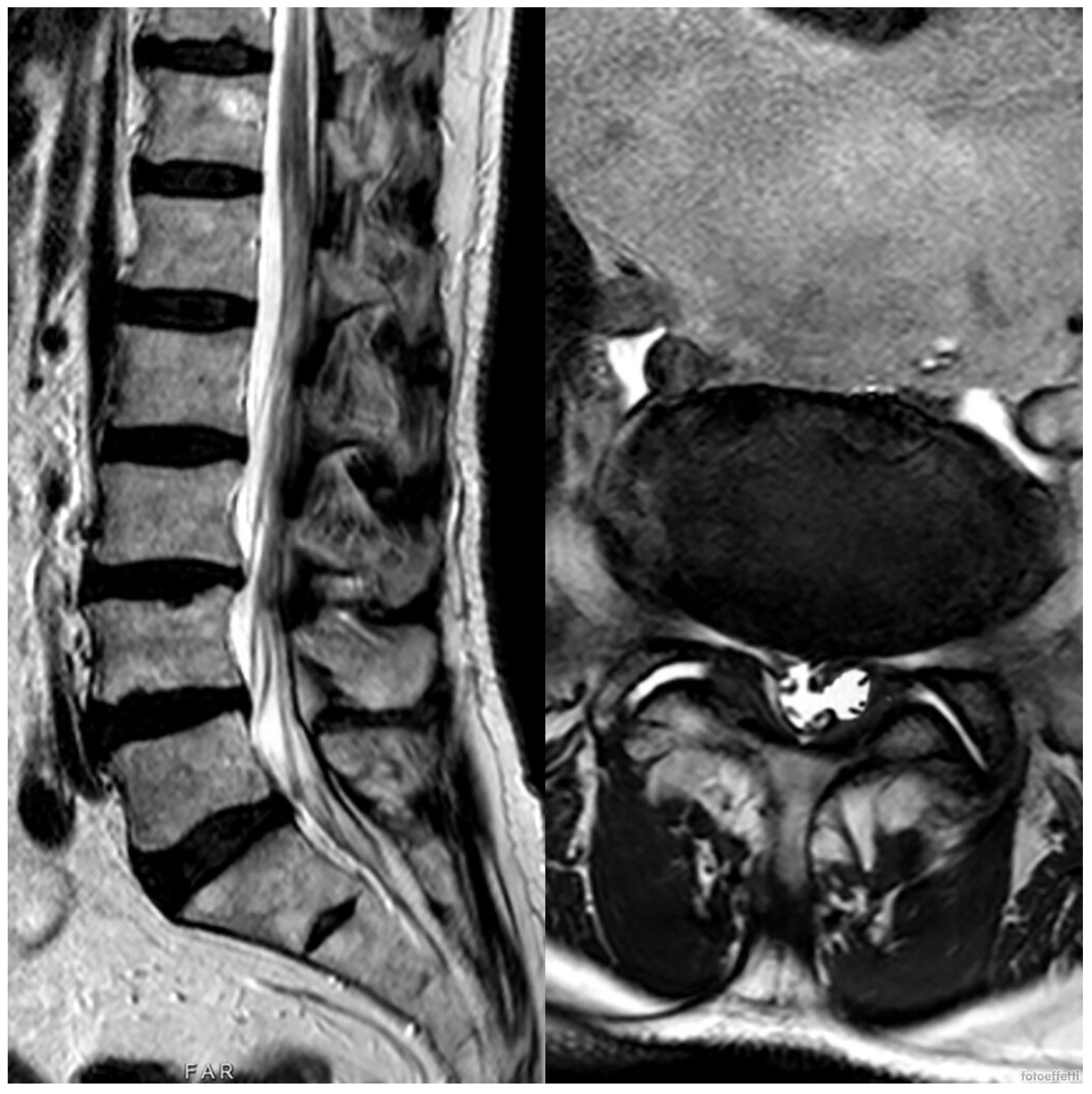 Medicina 60 01115 g002