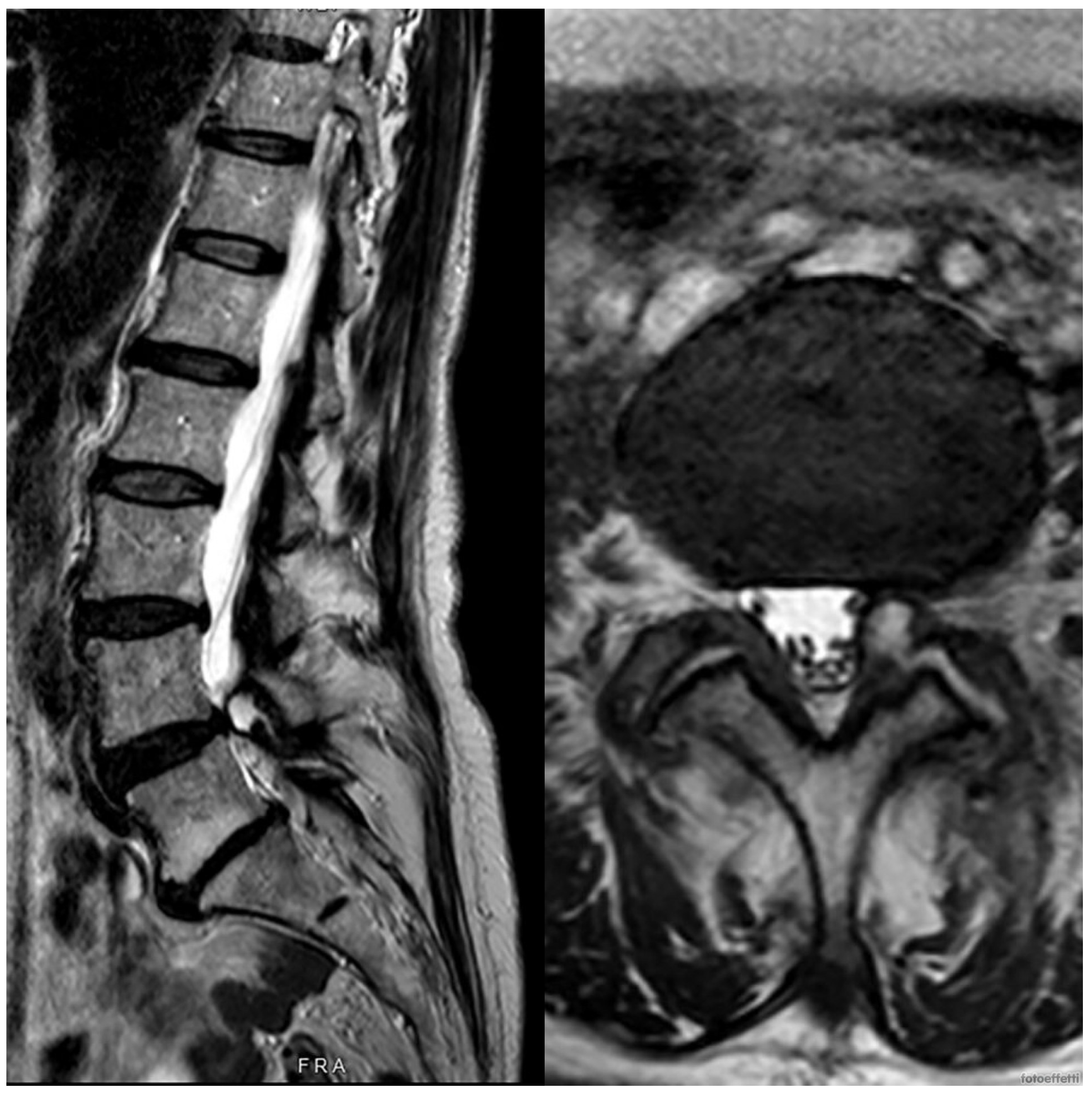 Medicina 60 01115 g003