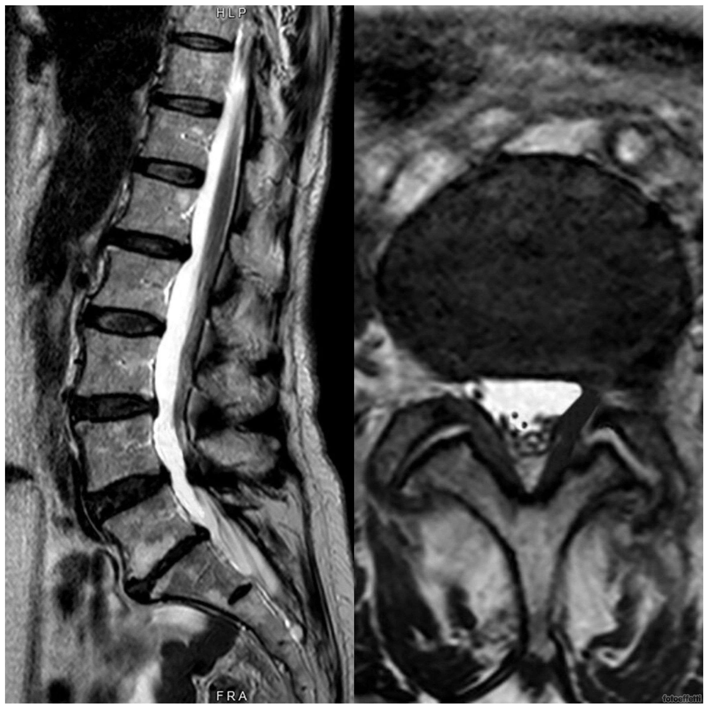 Medicina 60 01115 g004