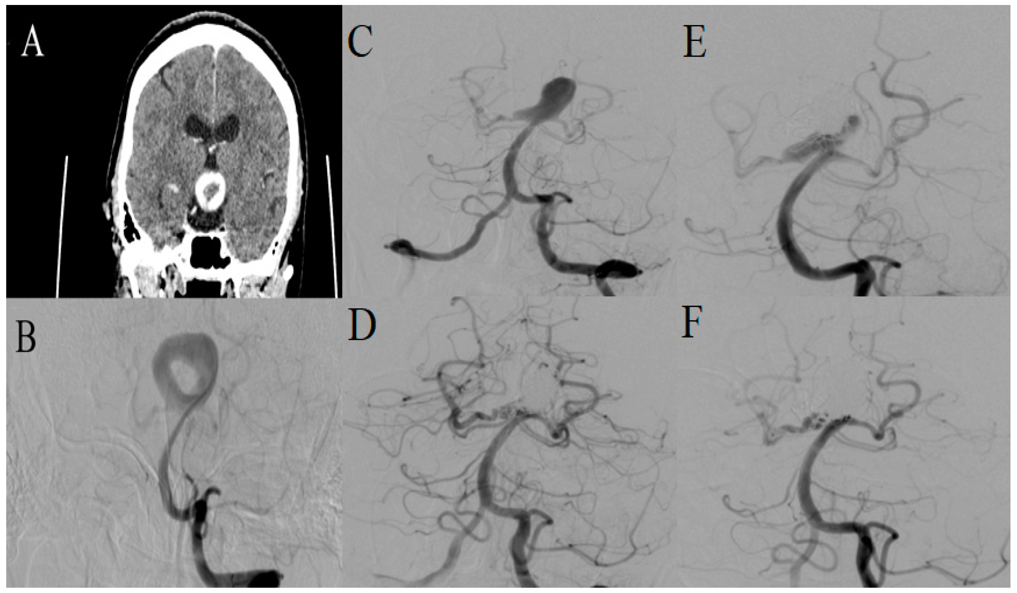 Medicina 60 01116 g004