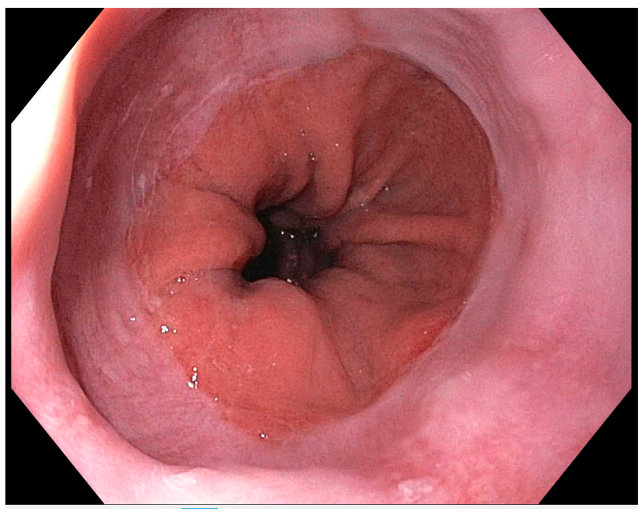 Medicina 60 01120 g002