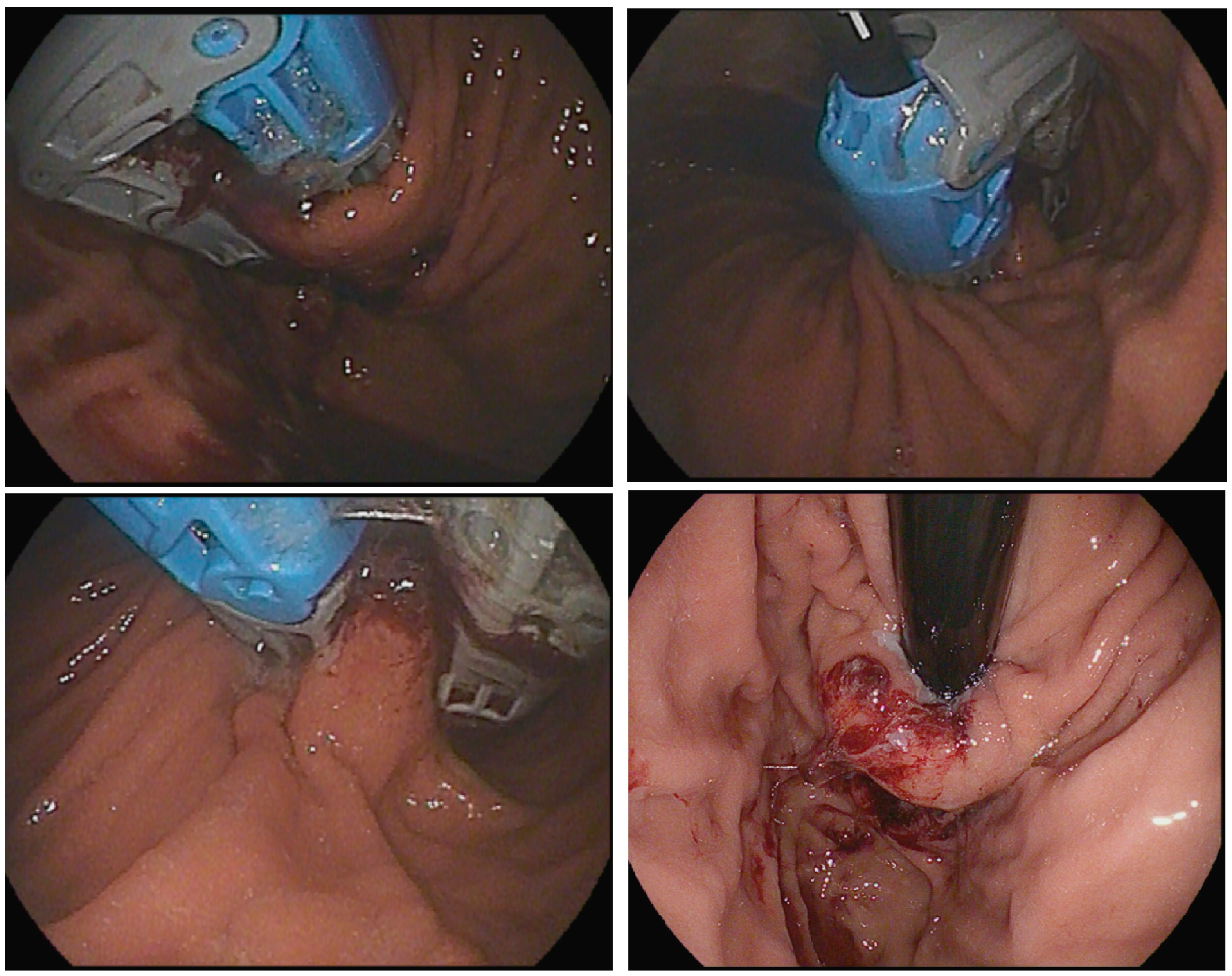 Medicina 60 01120 g005