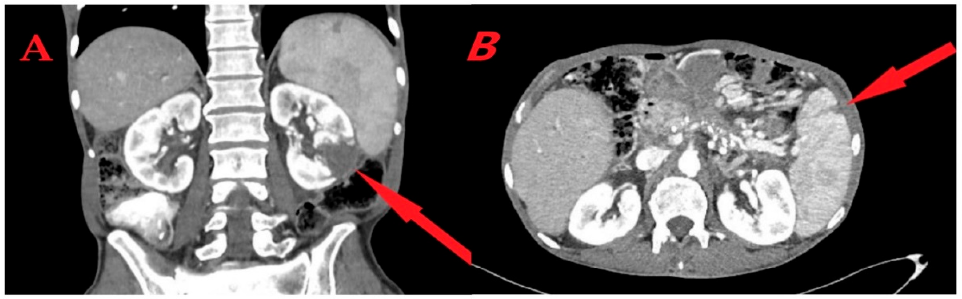 Medicina 60 01122 g001