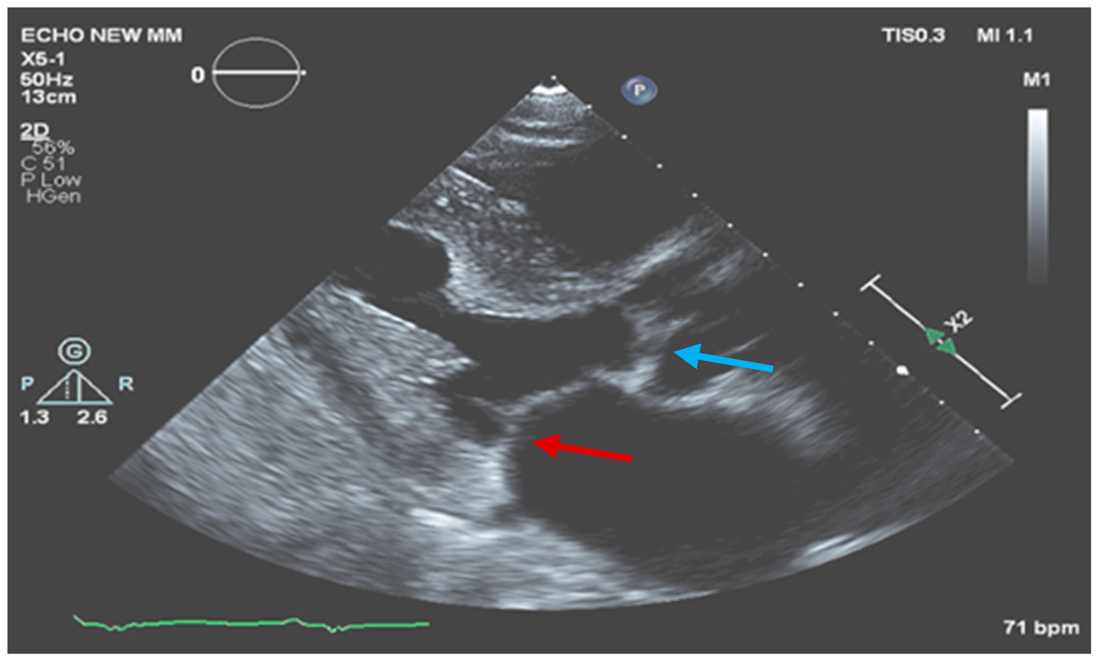 Medicina 60 01122 g003