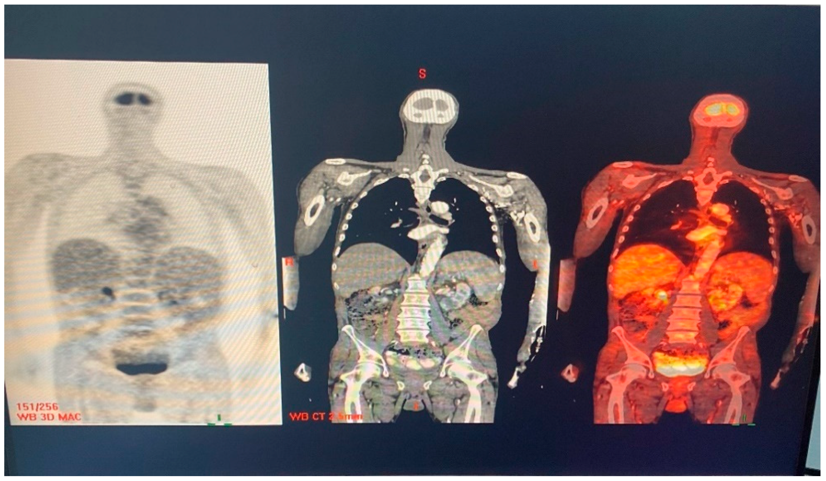 Medicina 60 01122 g004