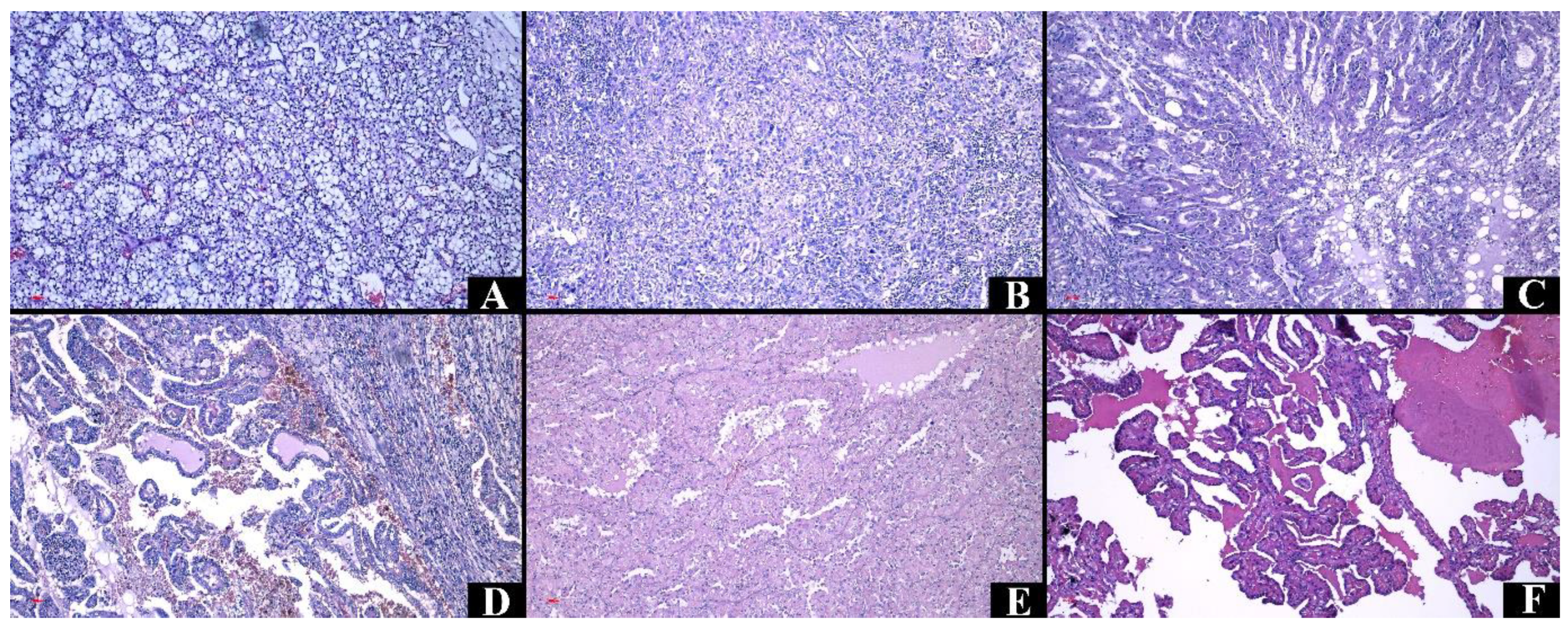 Medicina 60 01126 g004