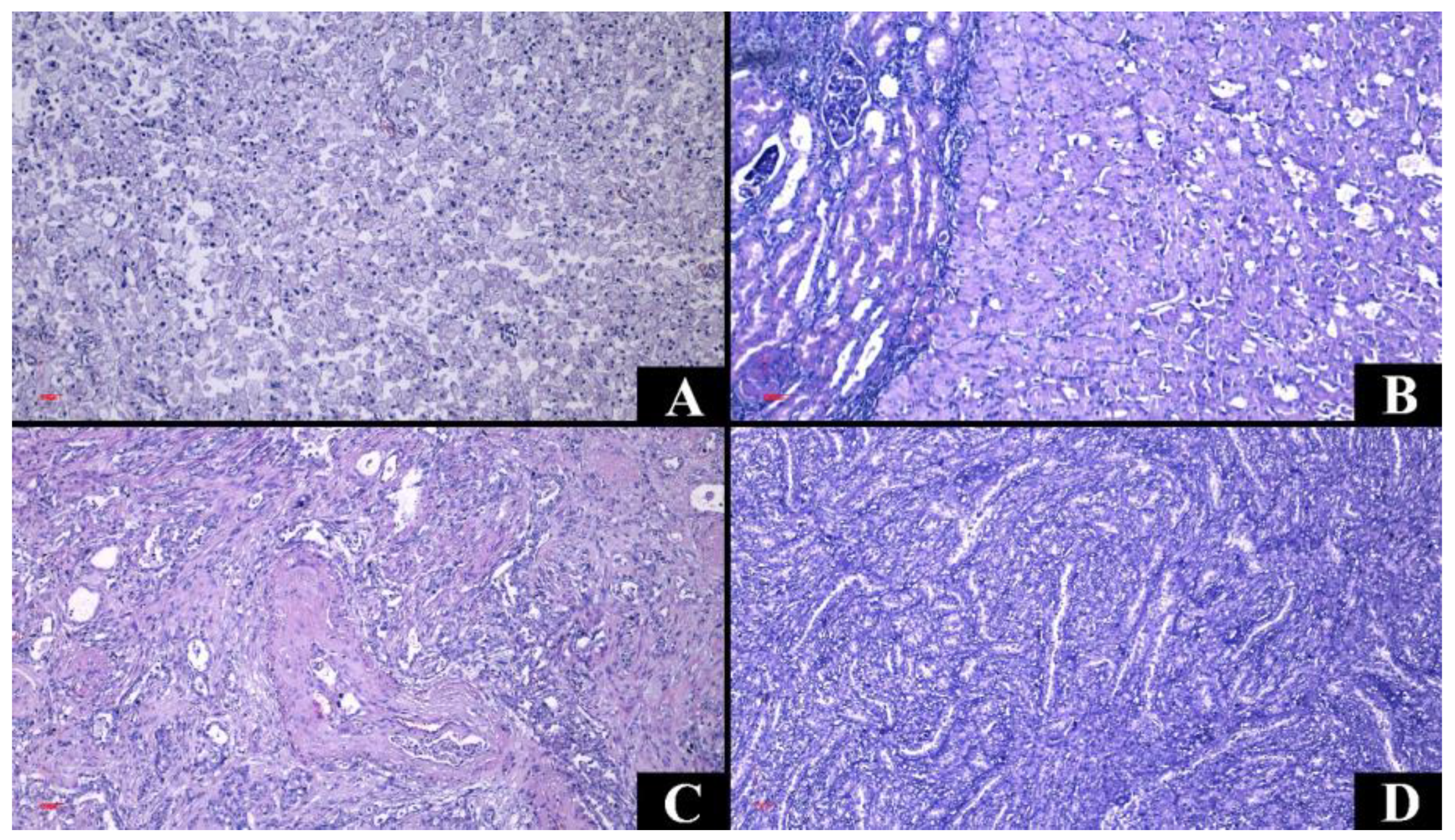 Medicina 60 01126 g005