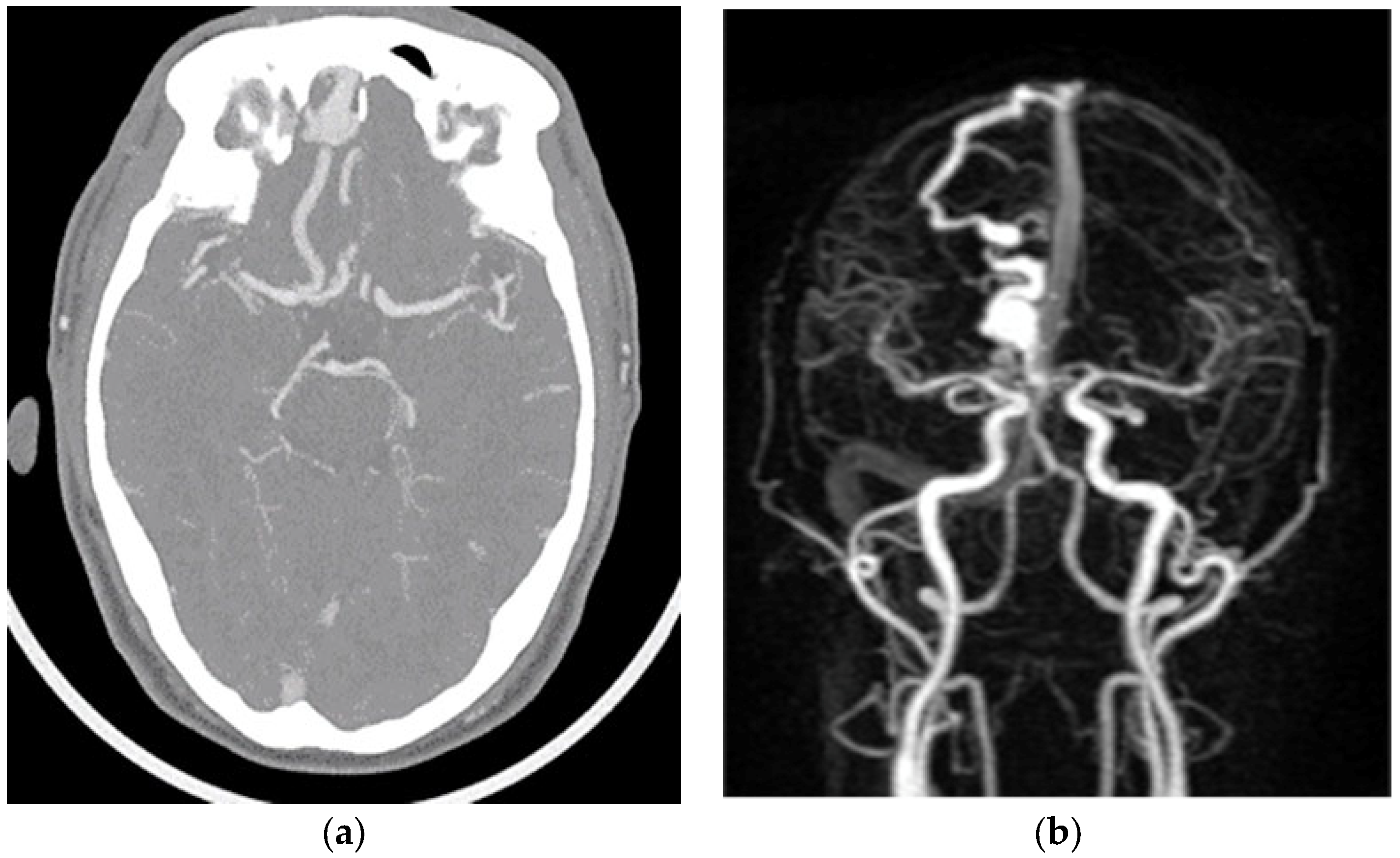 Medicina 60 01128 g001