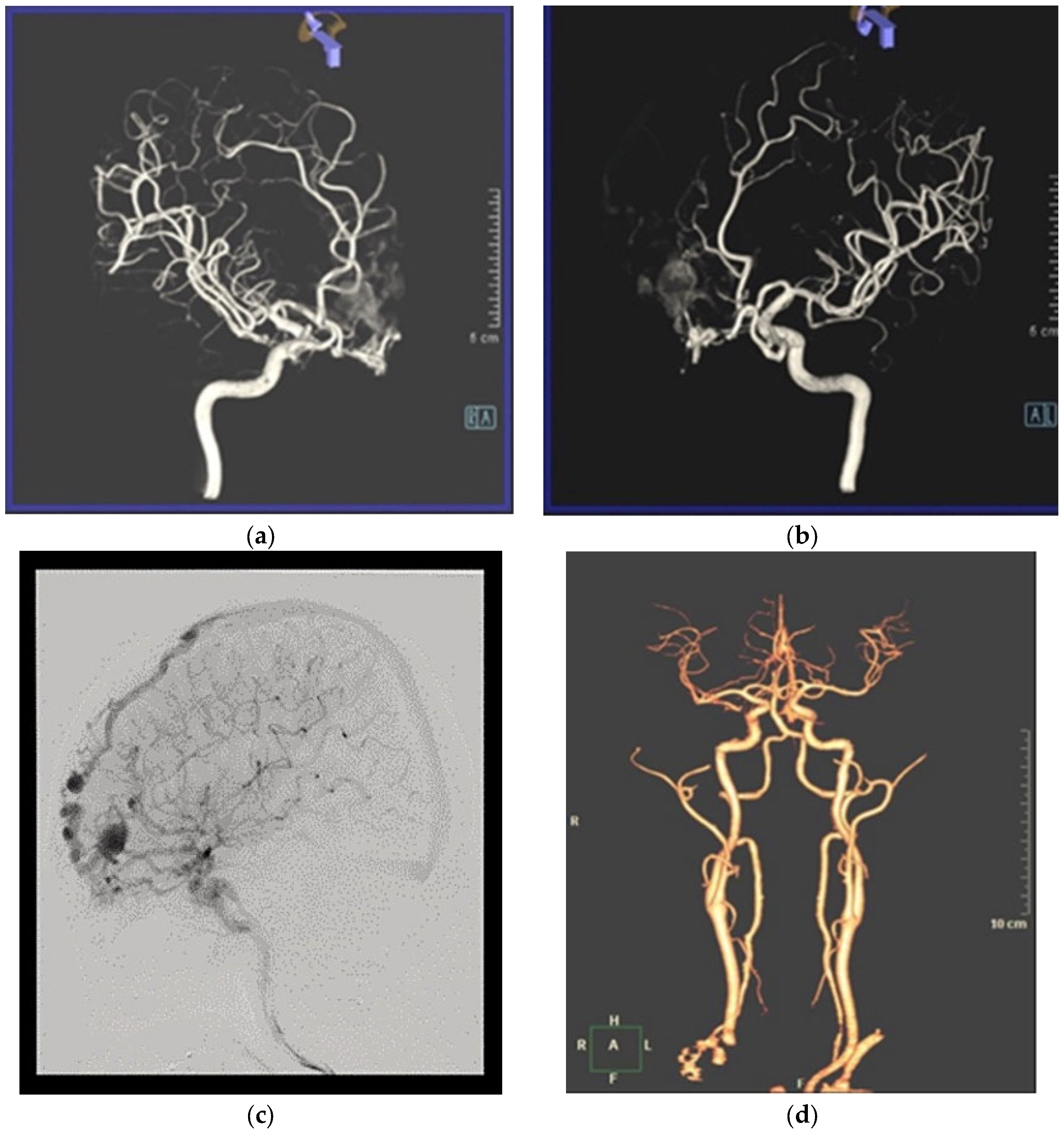 Medicina 60 01128 g002