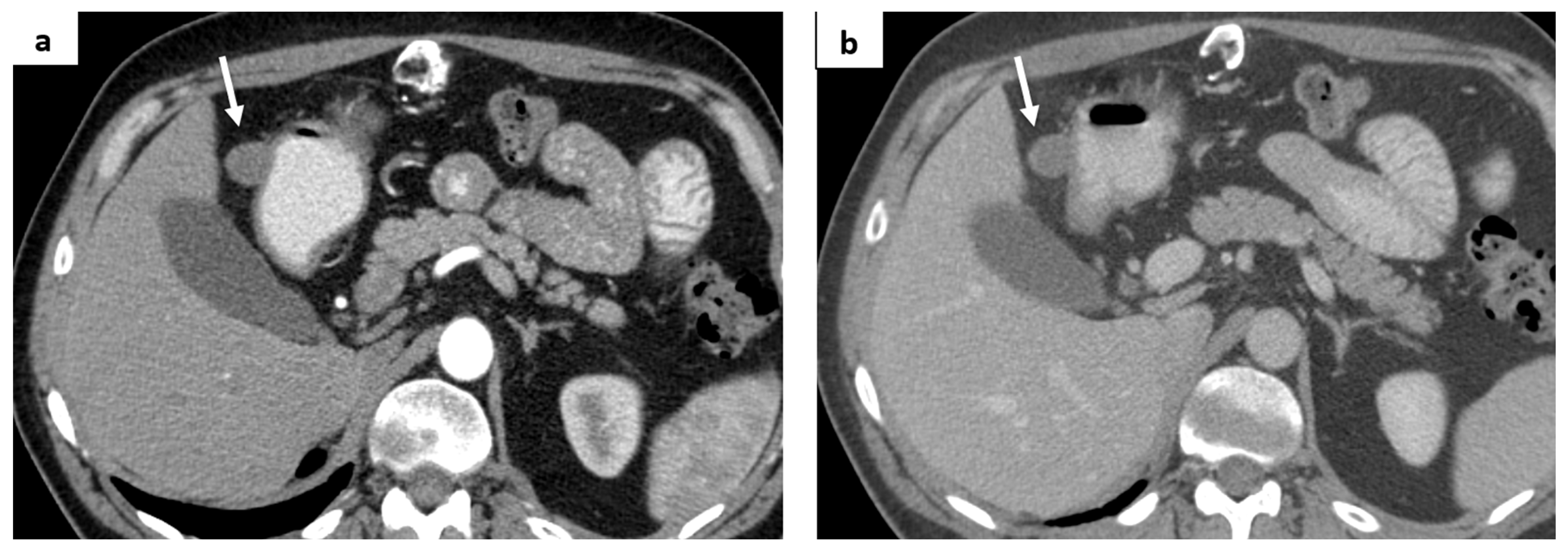 Medicina 60 01129 g005