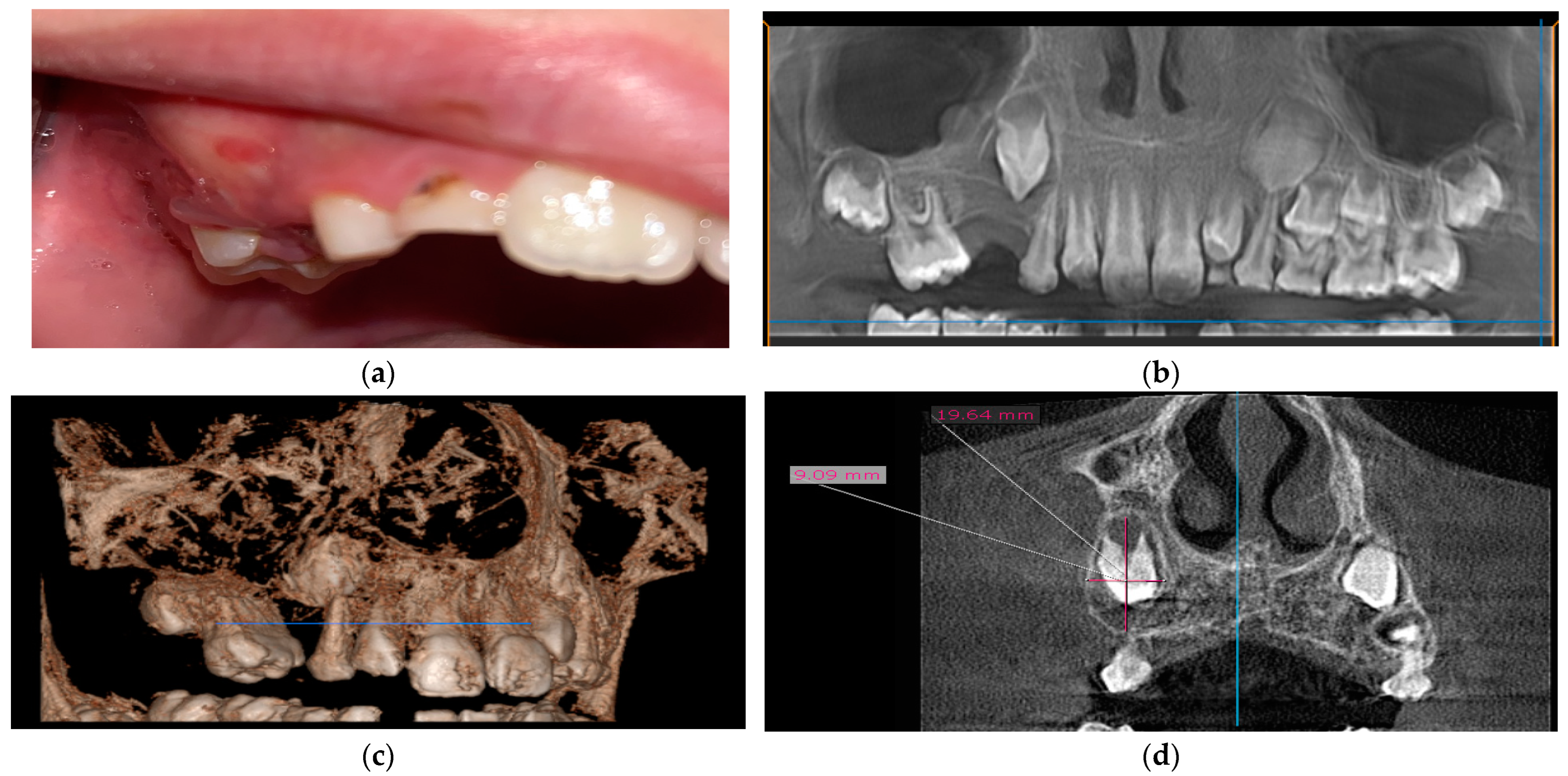 Medicina 60 01133 g001 Medicina 60 01133 g001